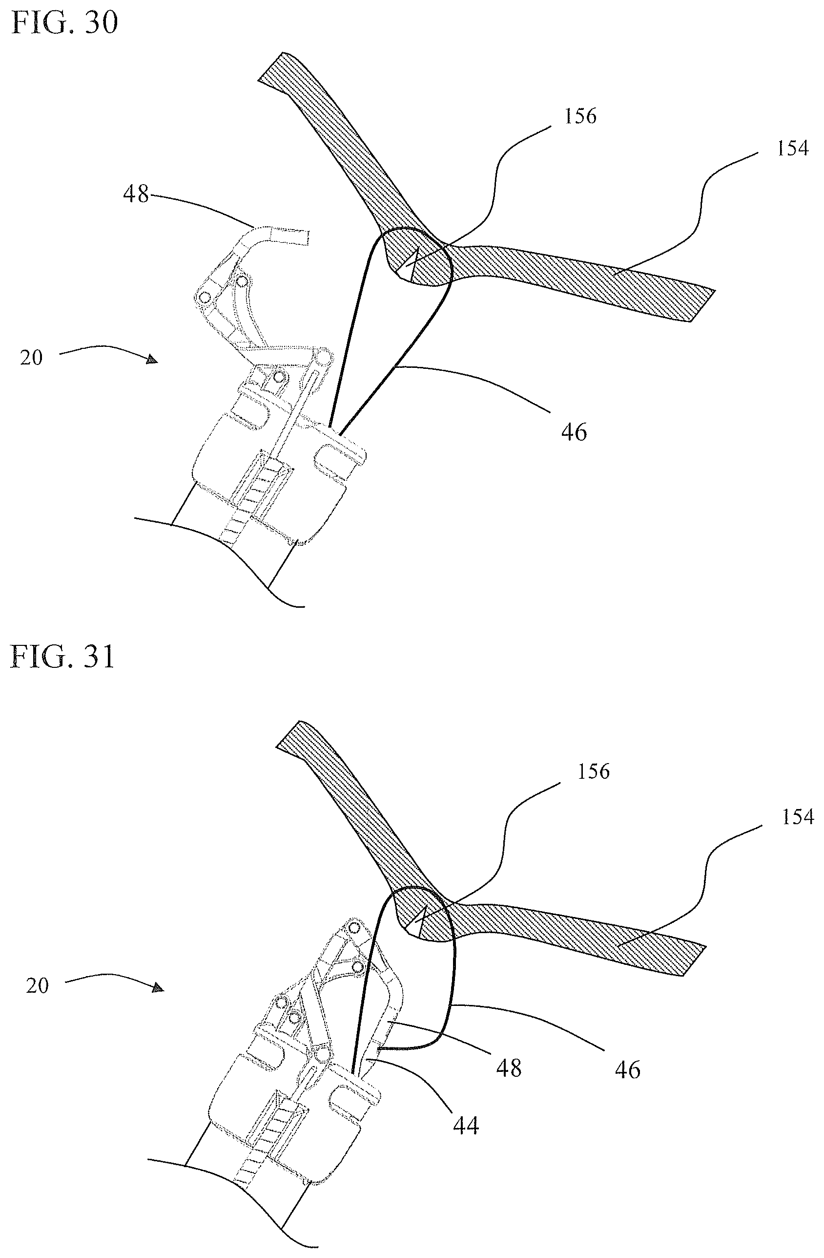 Patent US11812951 Figure 17 – Endoscopic needle assembly