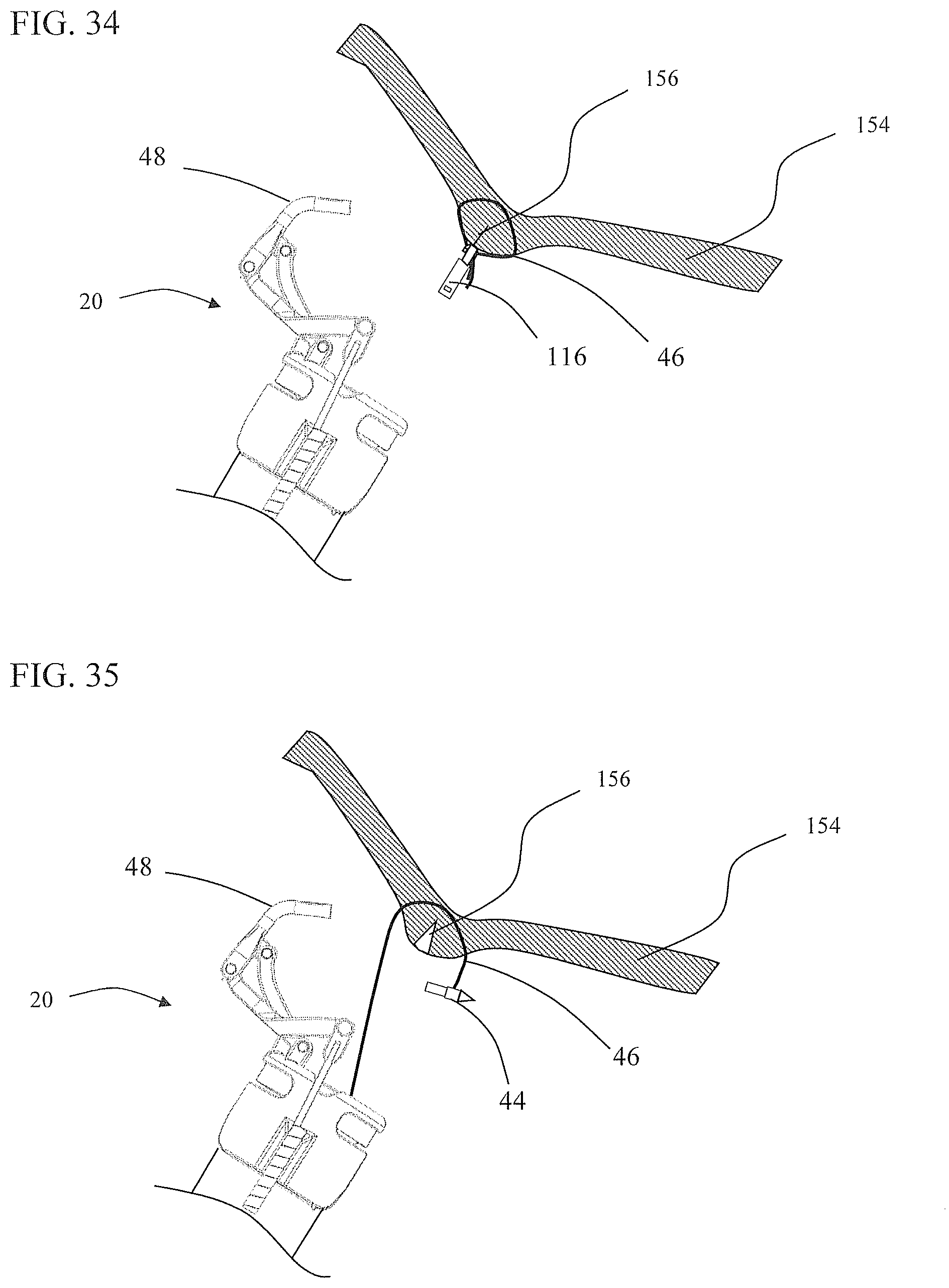 Patent US11812951 Figure 19 – Endoscopic needle assembly