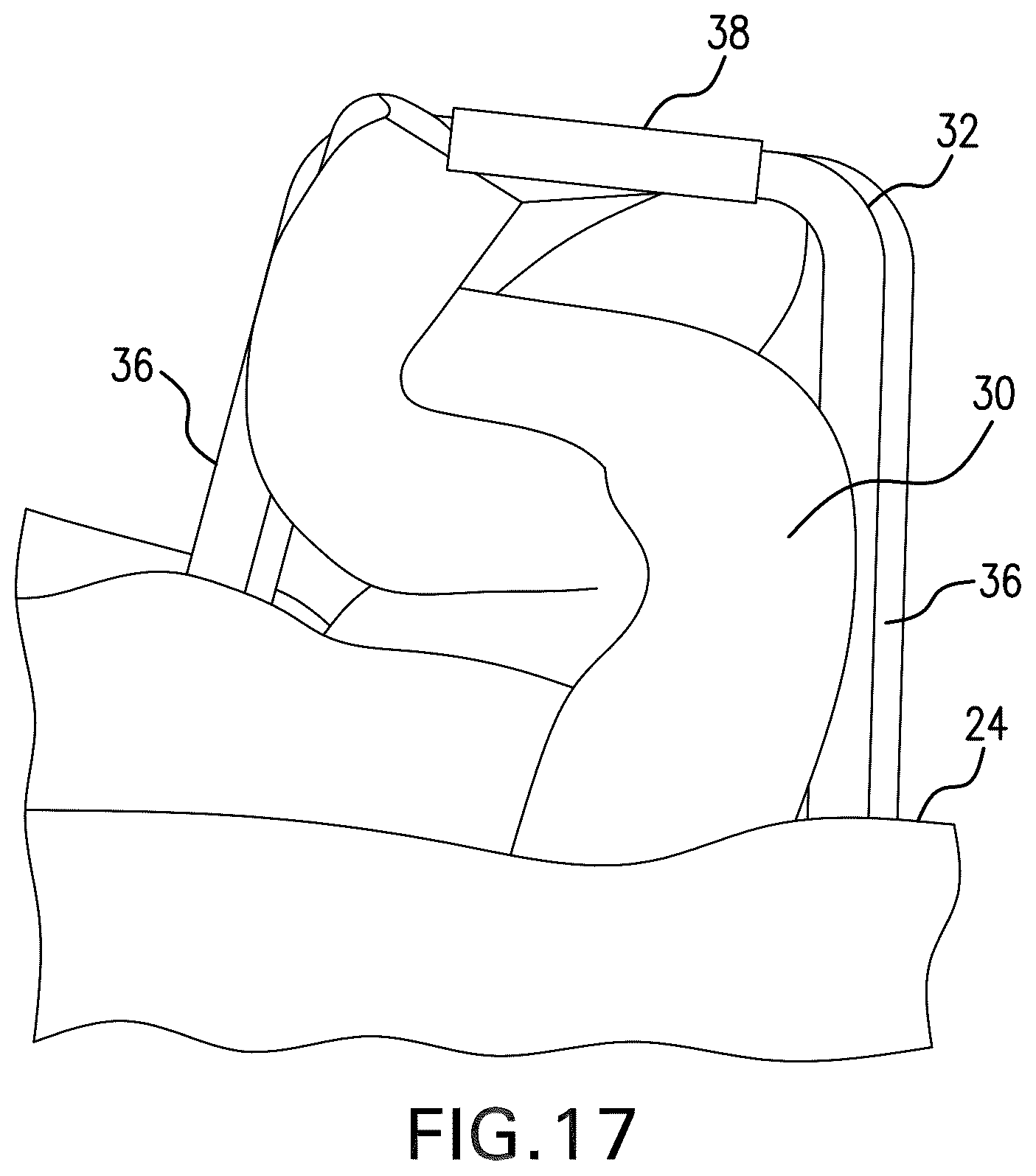 Patent US11812952 Figure 9 – Surgical implant and method and instrument for installing the same
