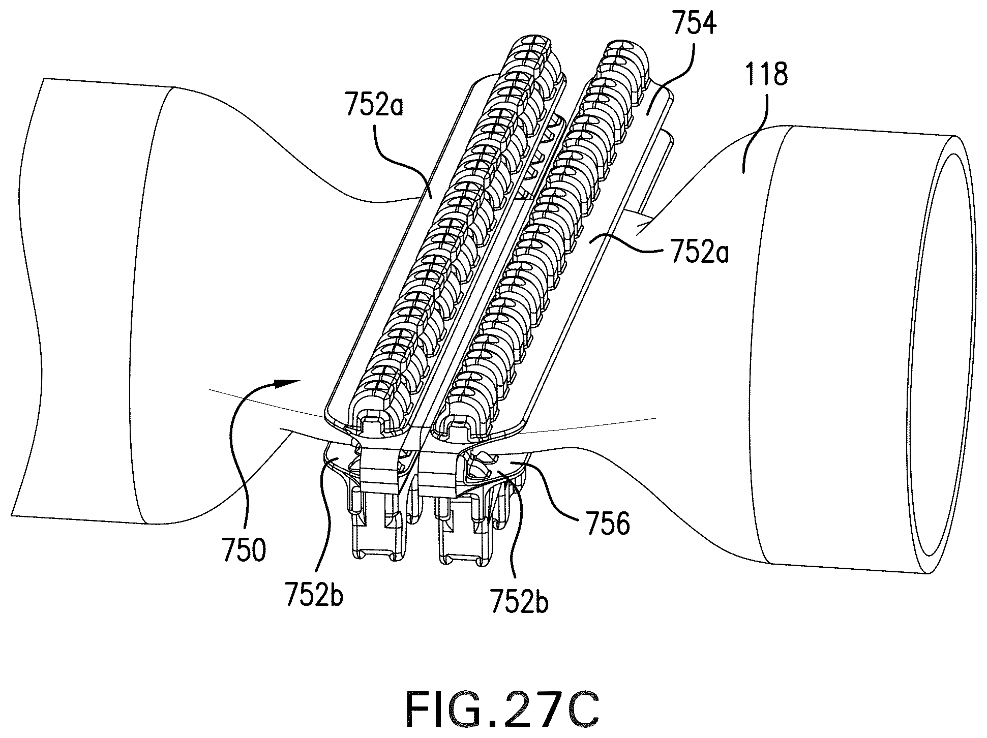Patent US11812952 Figure 14 – Surgical implant and method and instrument for installing the same