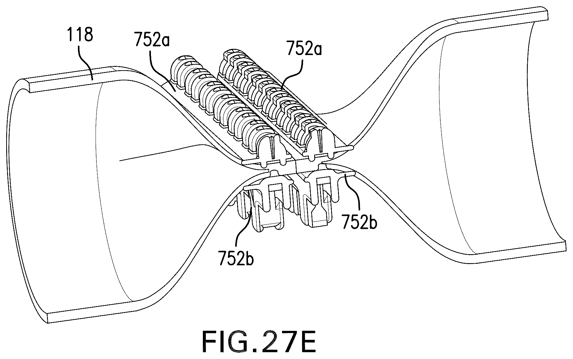 Patent US11812952 Figure 16 – Surgical implant and method and instrument for installing the same
