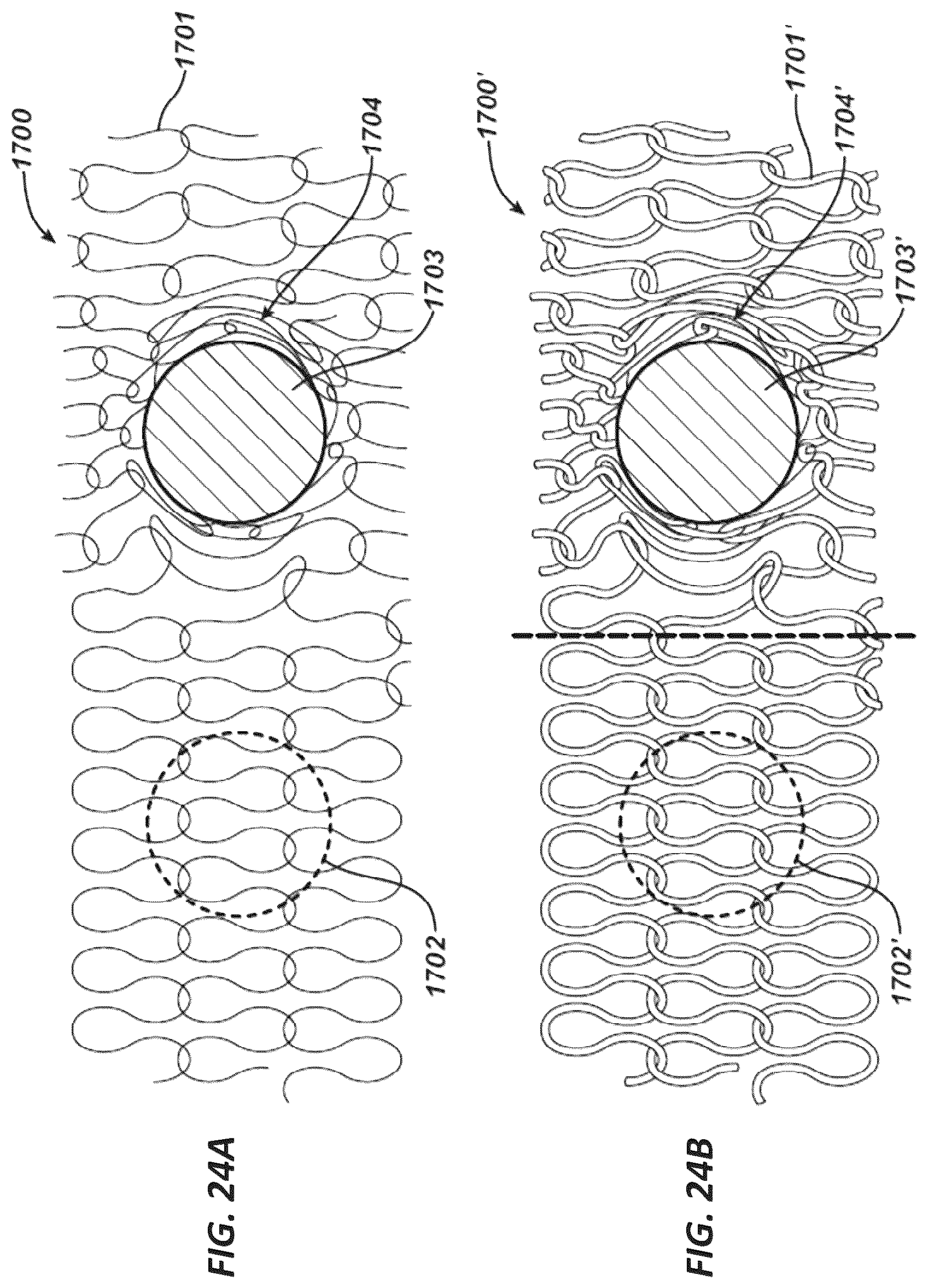 Patent US11812953 Figure 15 – Tissue ingrowth materials and method of using the same