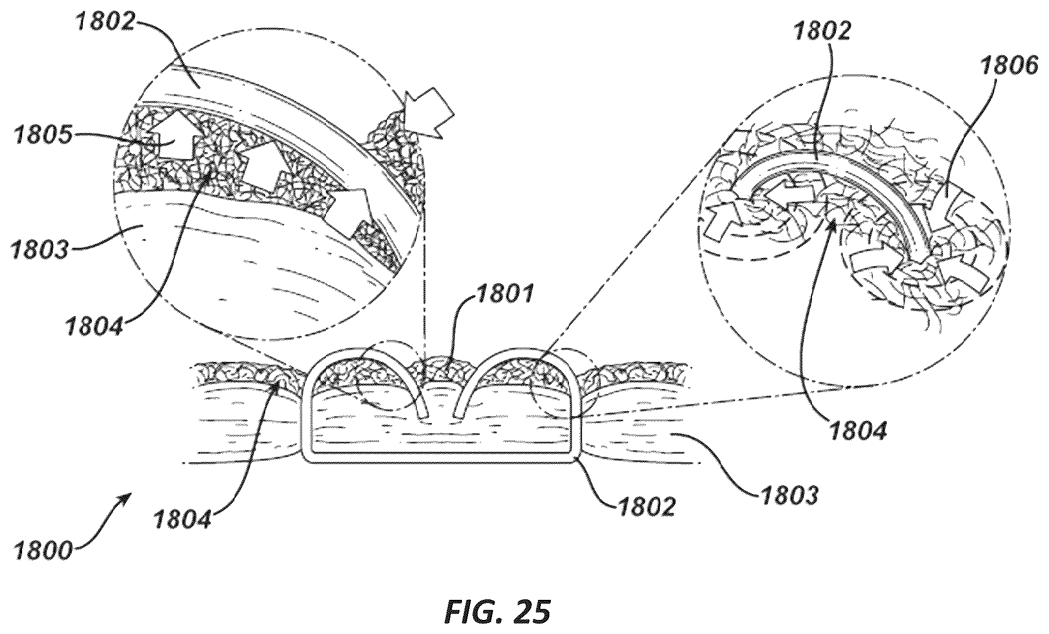Patent US11812953 Figure 16 – Tissue ingrowth materials and method of using the same