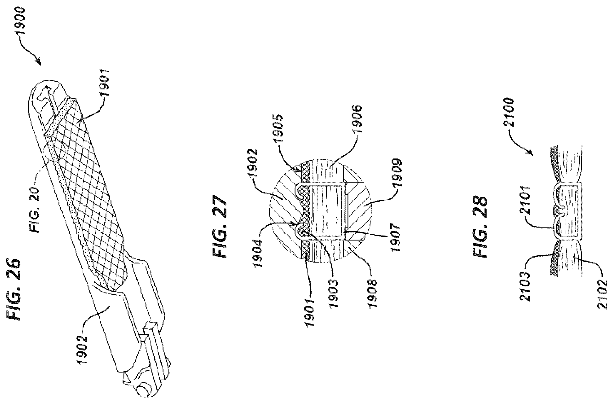 Patent US11812953 Figure 17 – Tissue ingrowth materials and method of using the same
