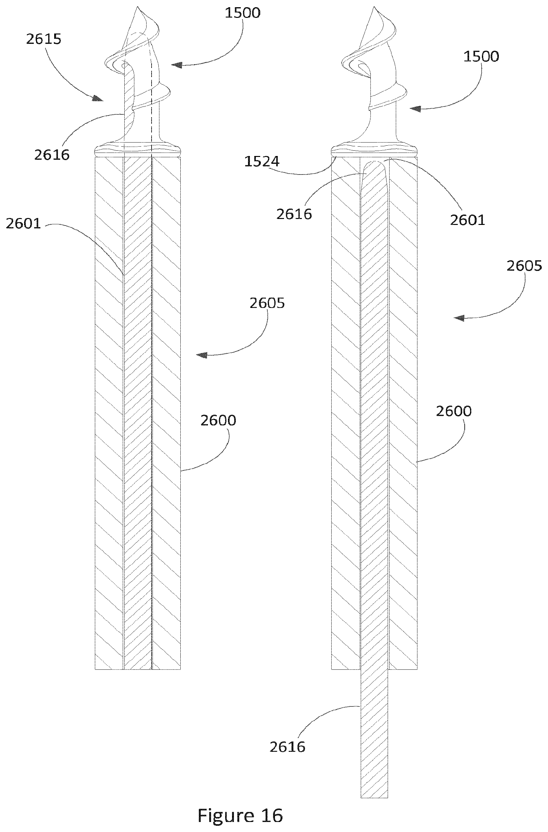 Patent US11812955 Figure 13 – Fixation device delivery system and methods