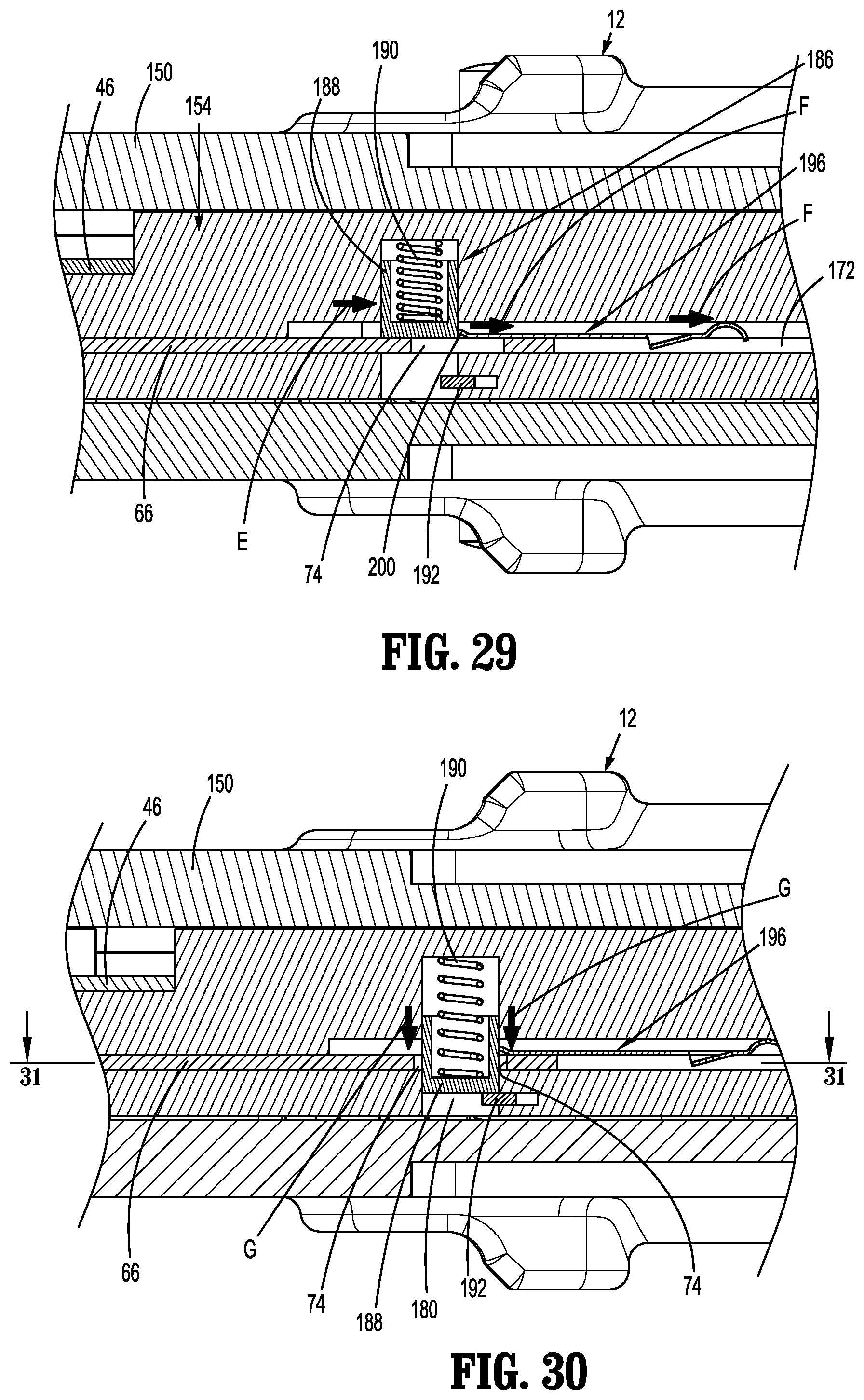 Patent US11812956 Figure 17 – Dual firing radial stapling device