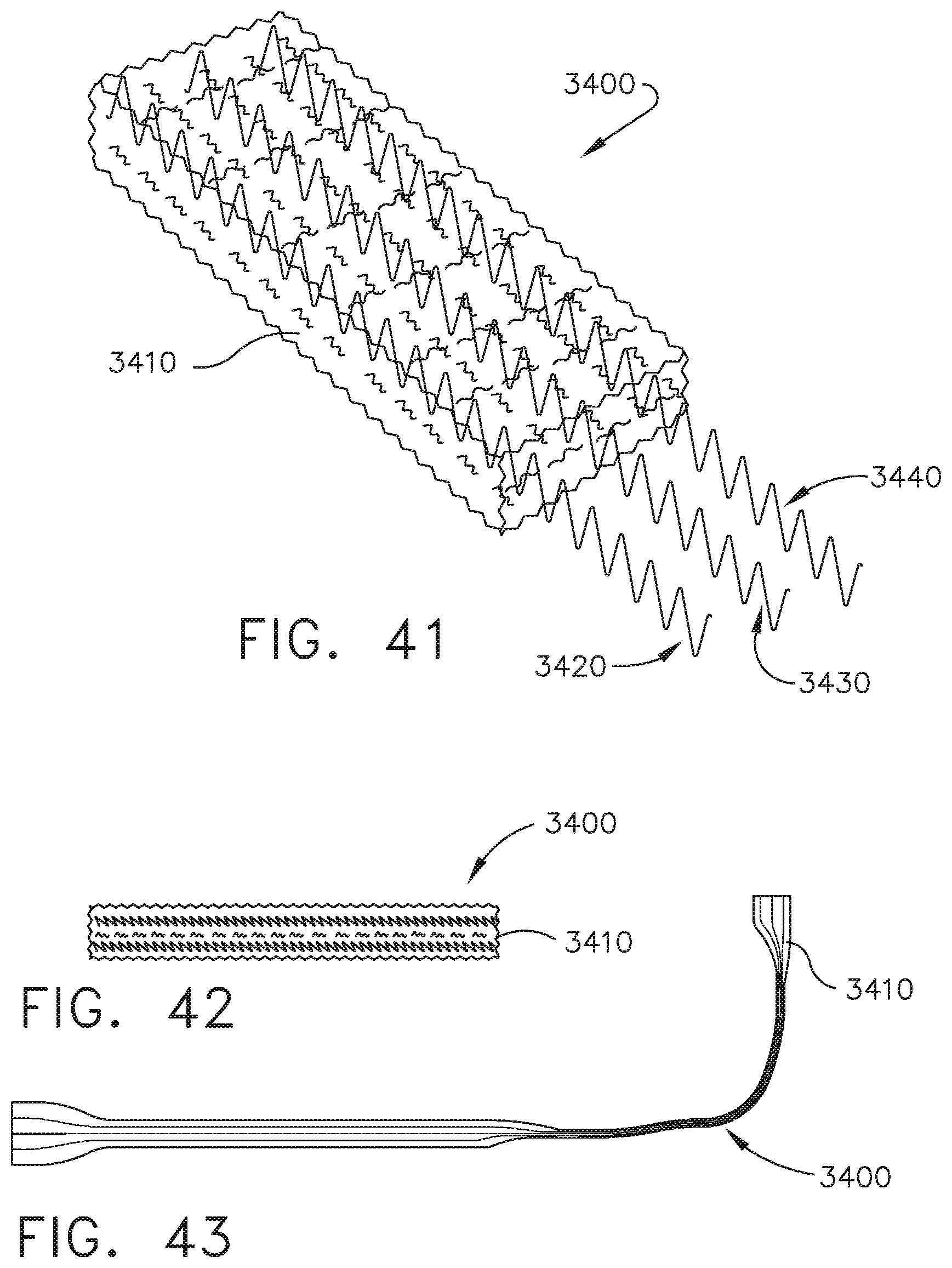 Patent US11812957 Figure 17 – Surgical instrument comprising a signal interference resolution system