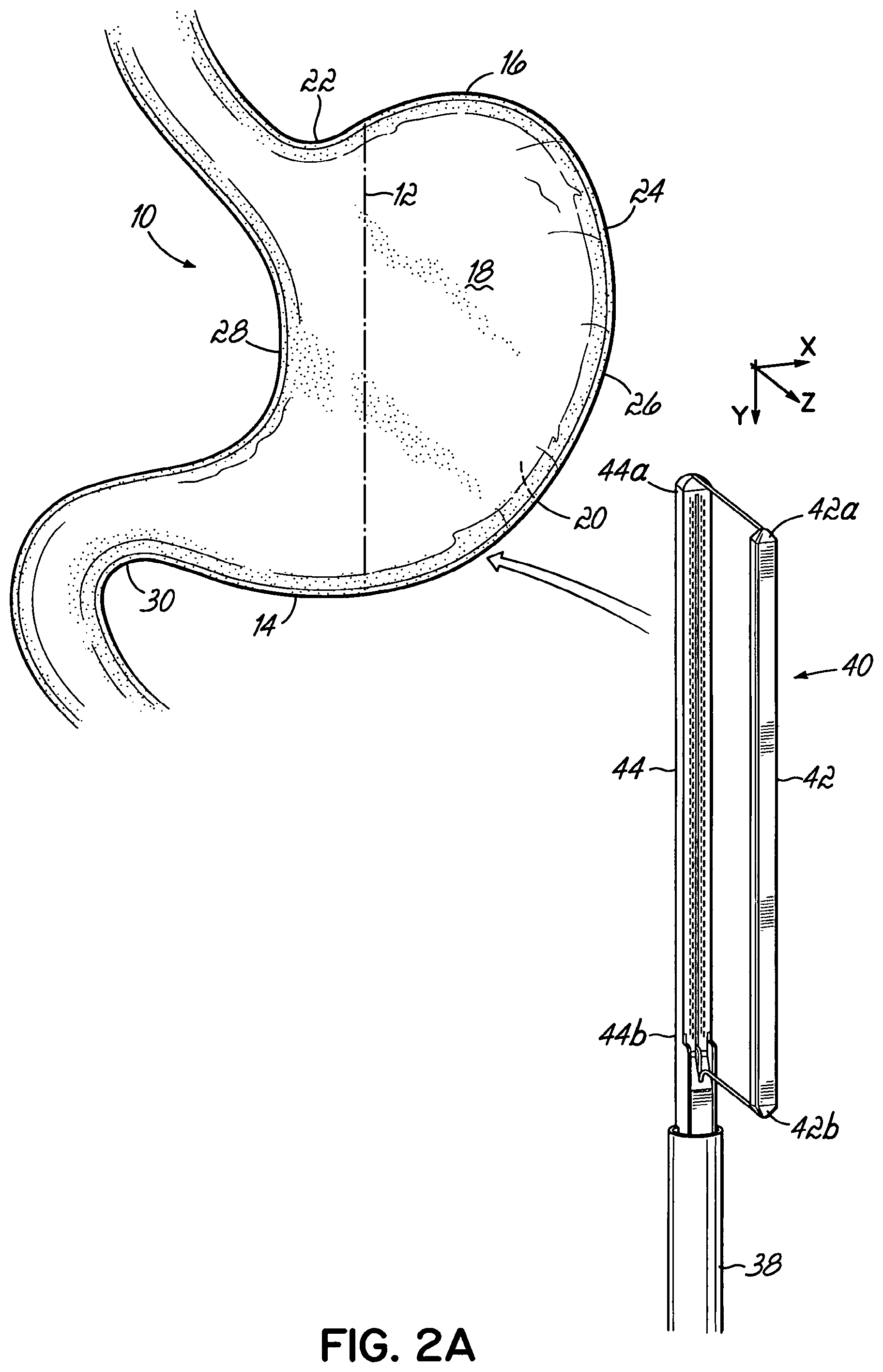 Patent US11812962 Figure 2 – End effectors, surgical stapling devices, and methods of using same