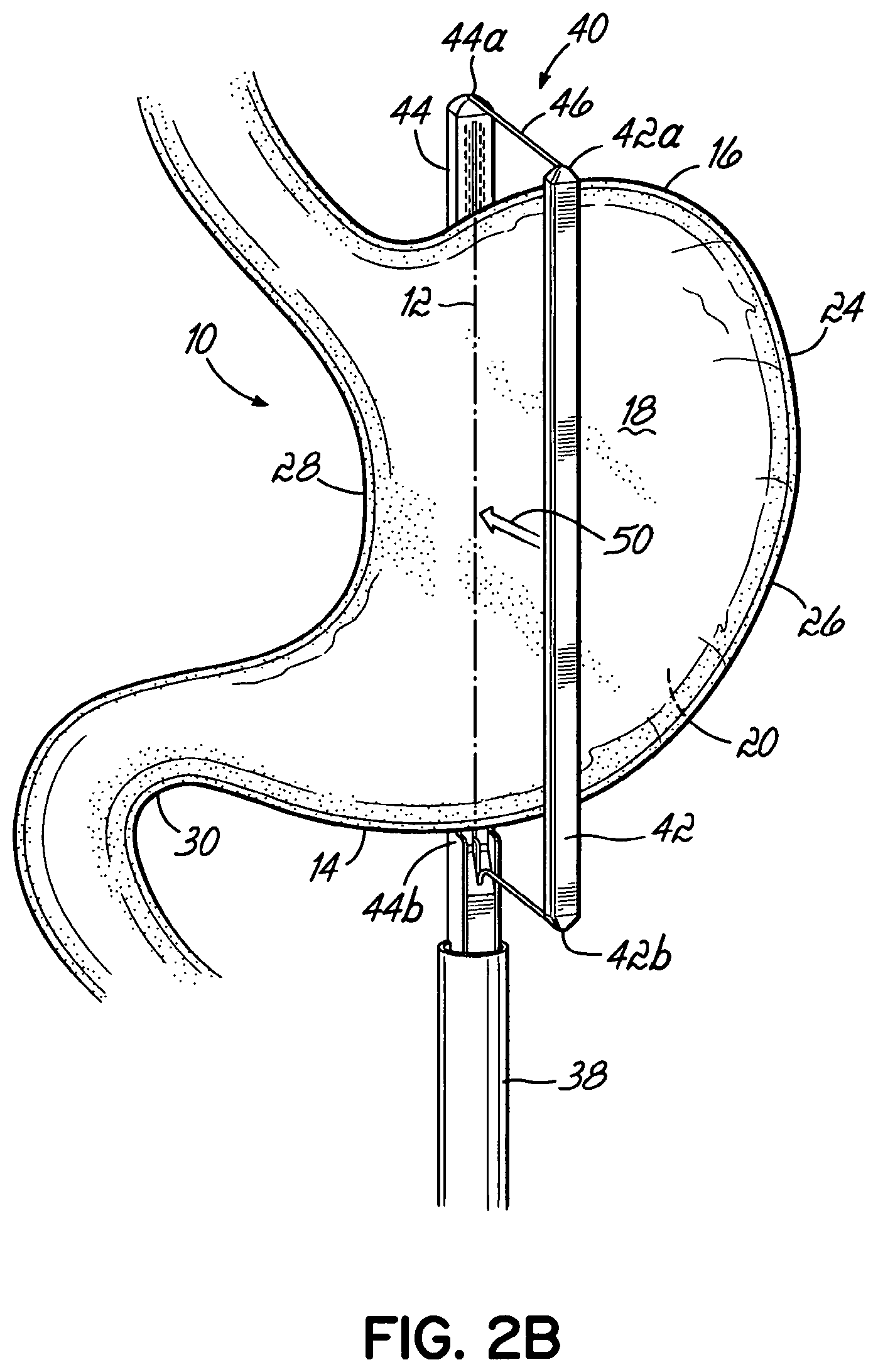 Patent US11812962 Figure 3 – End effectors, surgical stapling devices, and methods of using same