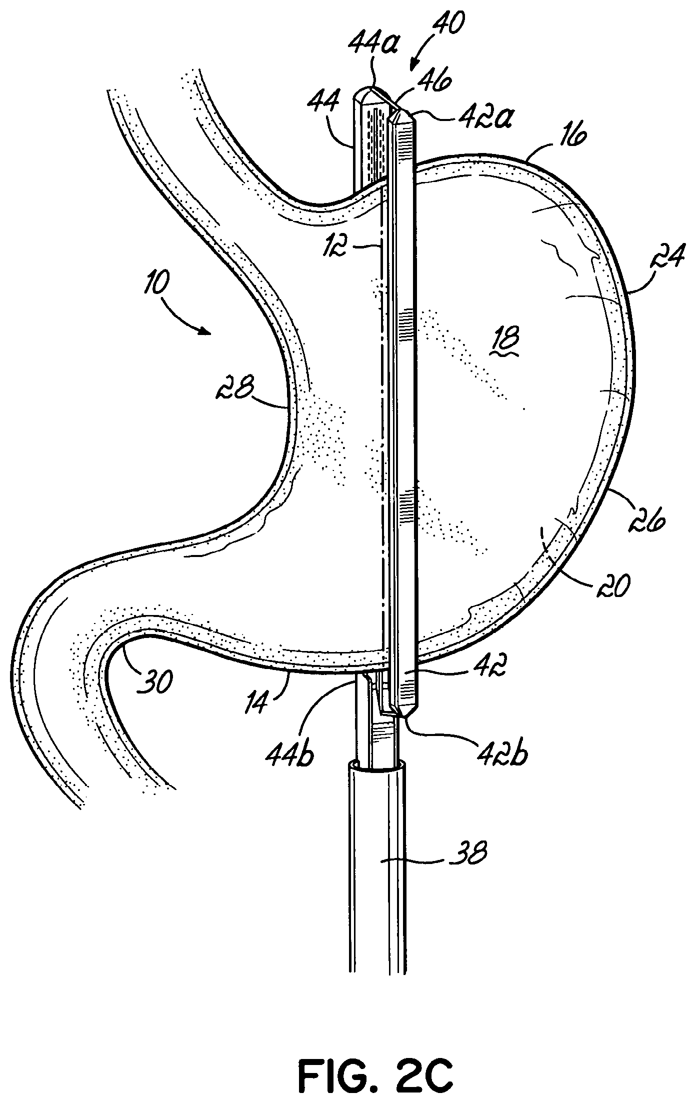 Patent US11812962 Figure 4 – End effectors, surgical stapling devices, and methods of using same