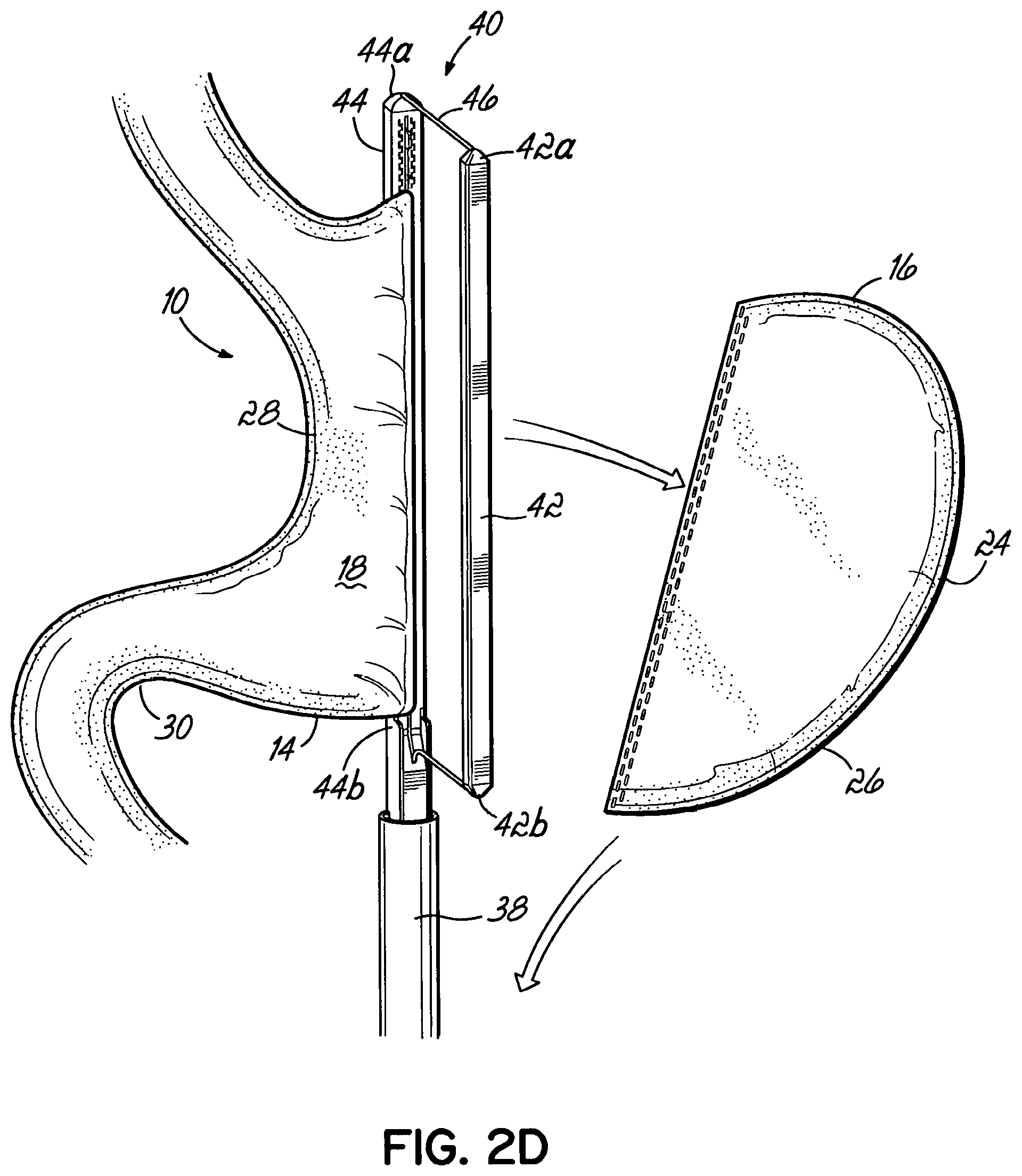 Patent US11812962 Figure 5 – End effectors, surgical stapling devices, and methods of using same