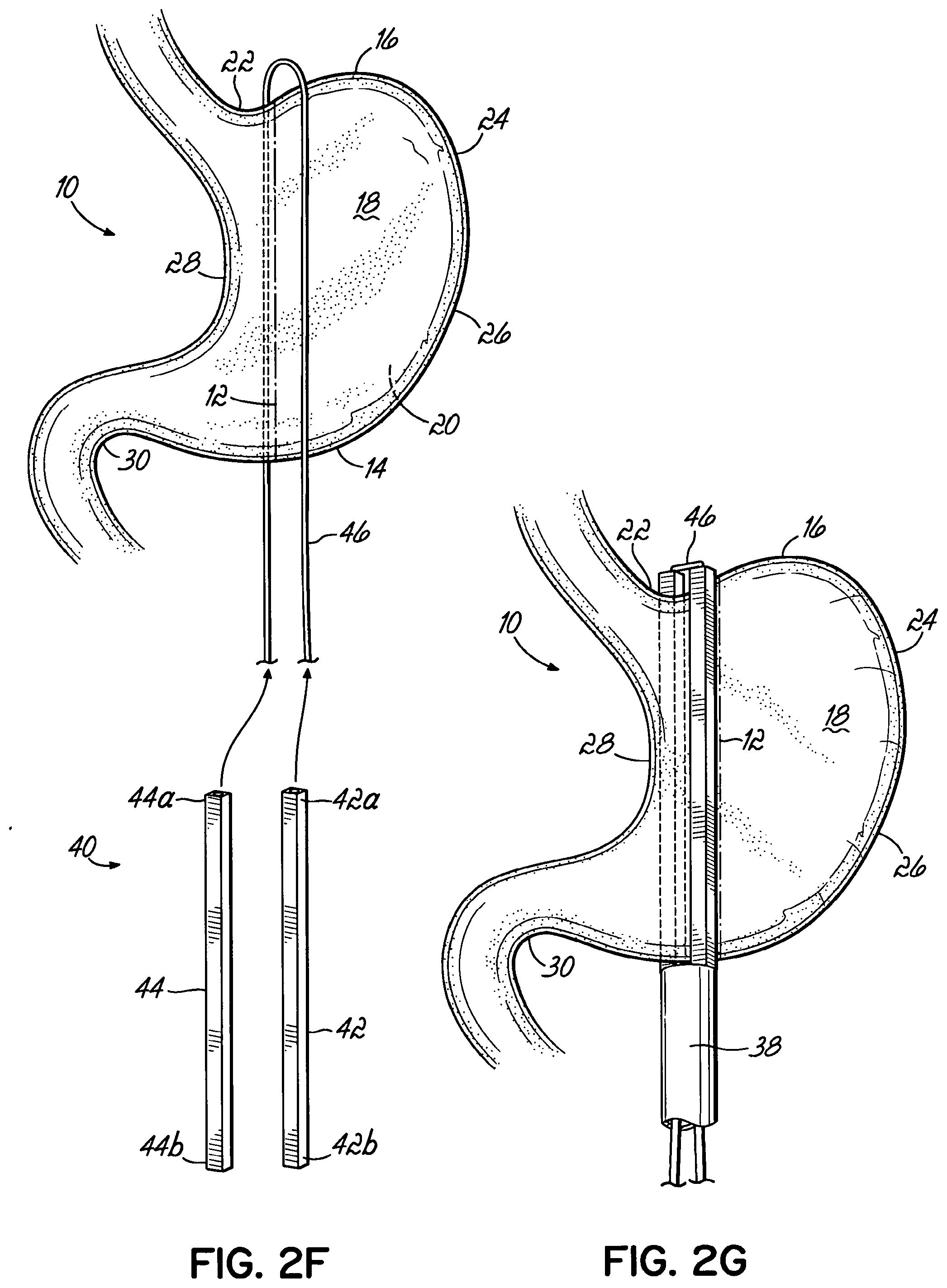 Patent US11812962 Figure 7 – End effectors, surgical stapling devices, and methods of using same