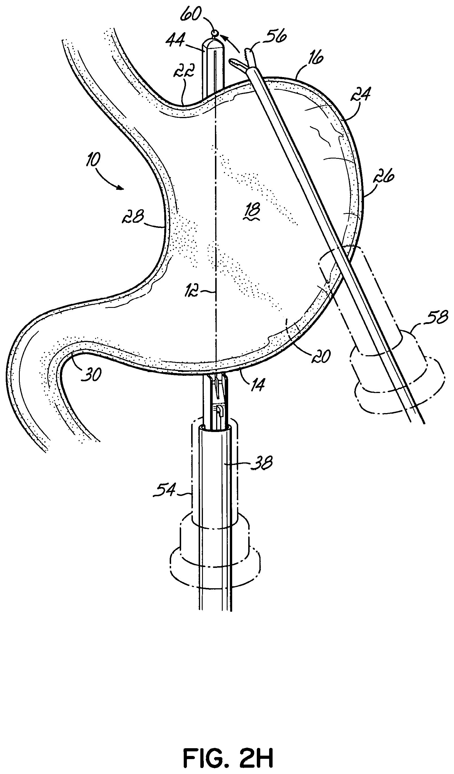 Patent US11812962 Figure 8 – End effectors, surgical stapling devices, and methods of using same