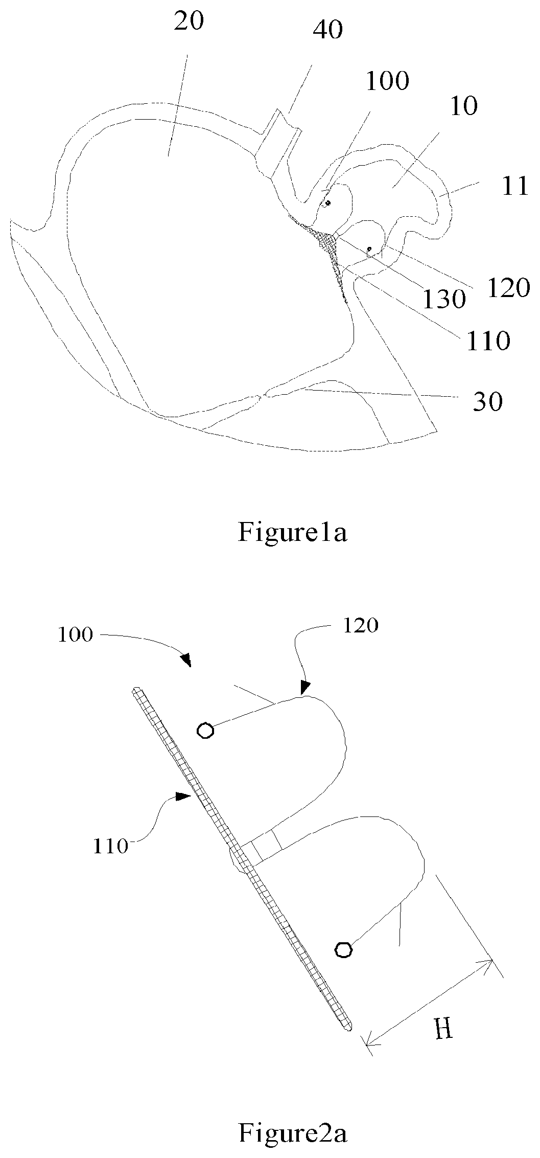 Patent US11812968 Figure 9 – Left atrial appendage occluder