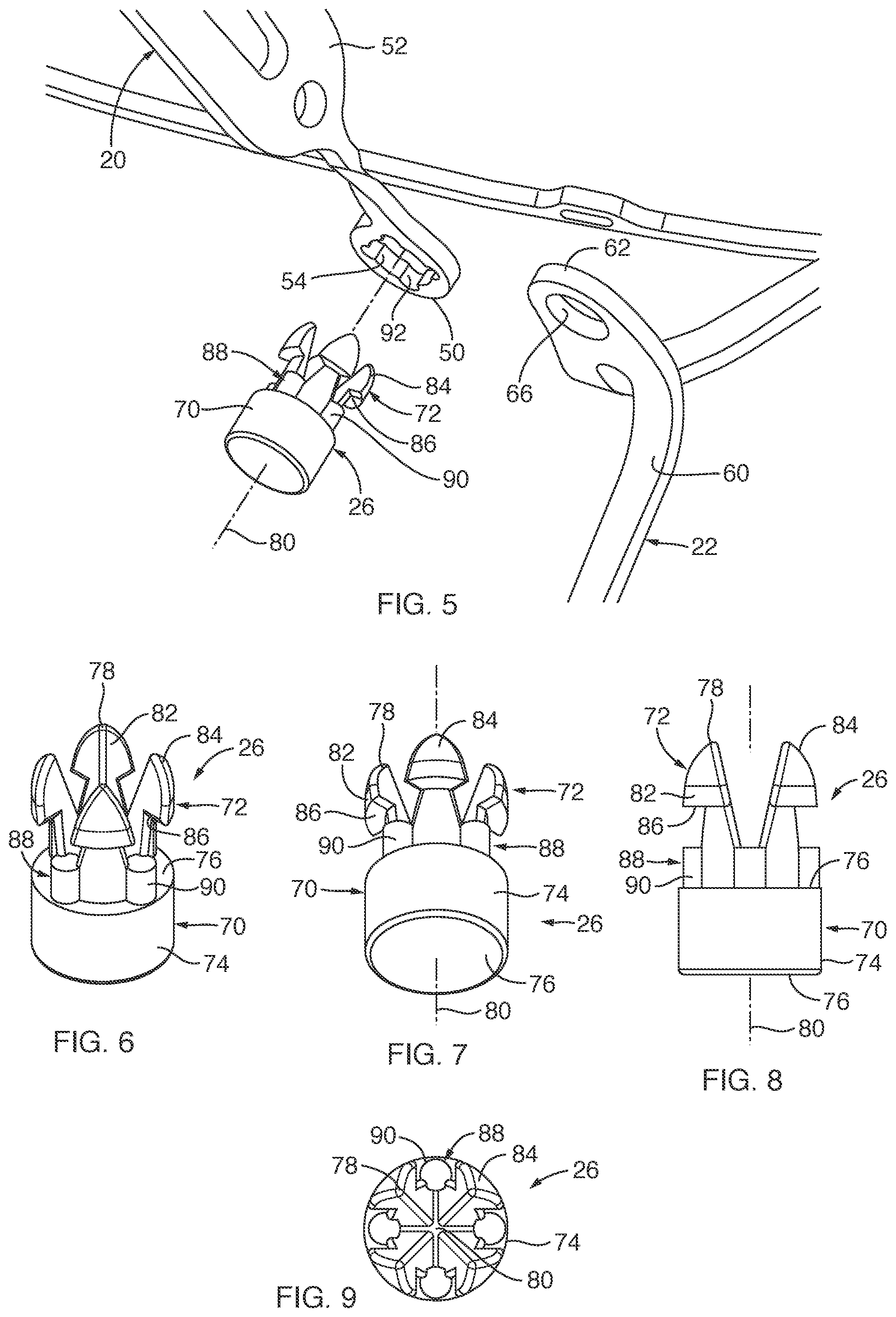 Patent US11812969 Figure 4 – Medical device and system for occluding a tissue opening and method thereof