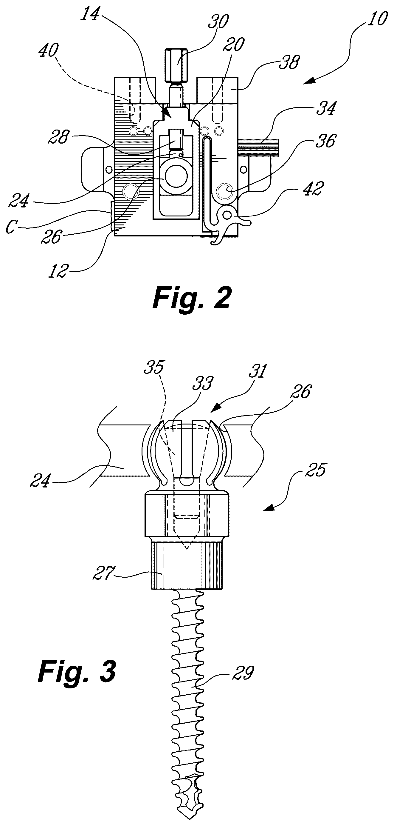 Patent US11812974 Figure 2 – Method and system for planning/guiding alterations to a bone