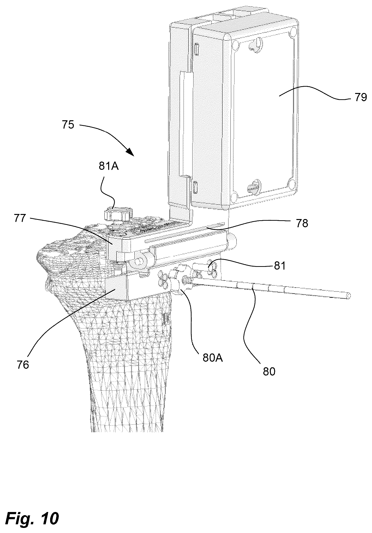 Patent US11812974 Figure 9 – Method and system for planning/guiding alterations to a bone