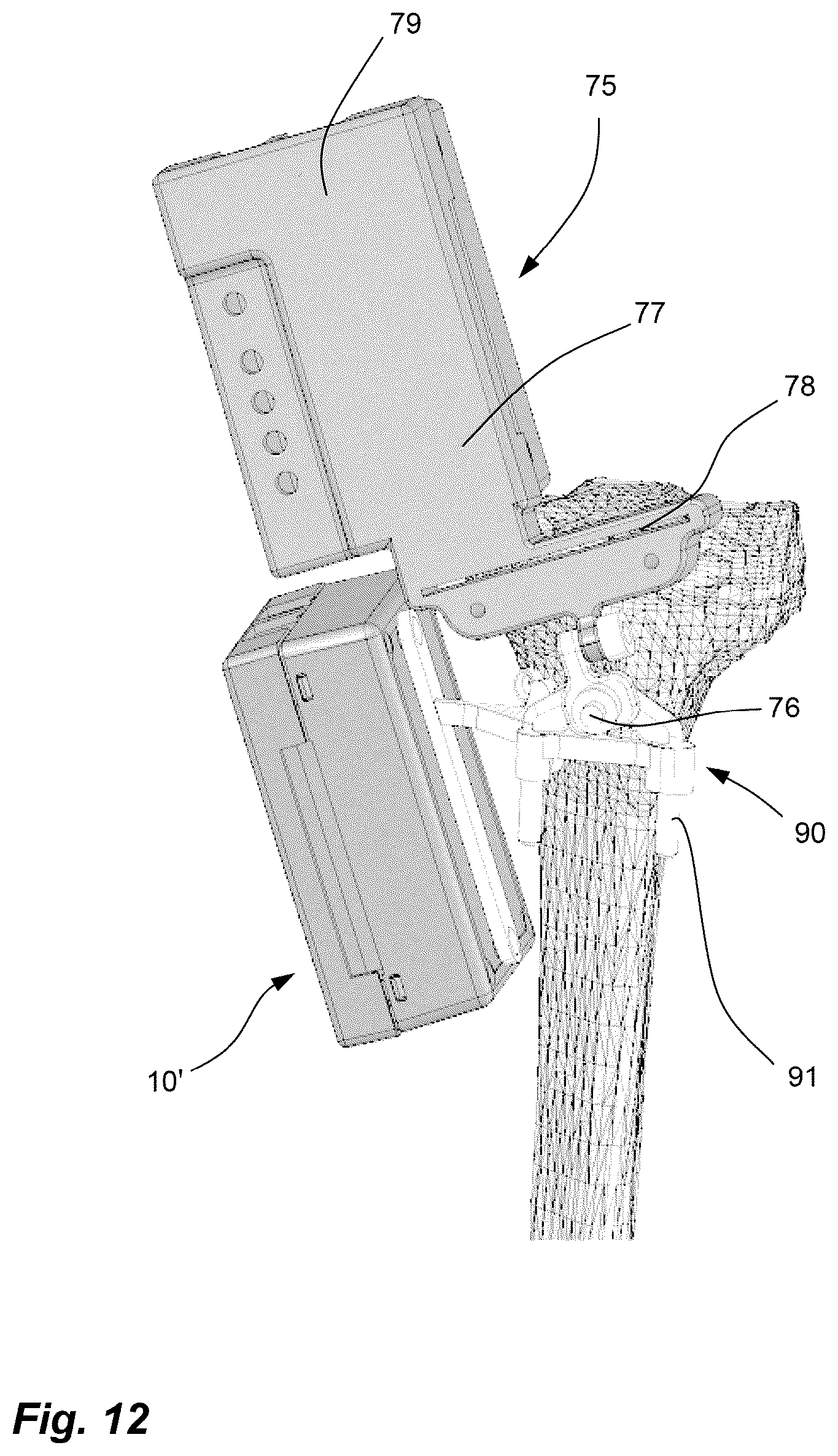 Patent US11812974 Figure 11 – Method and system for planning/guiding alterations to a bone