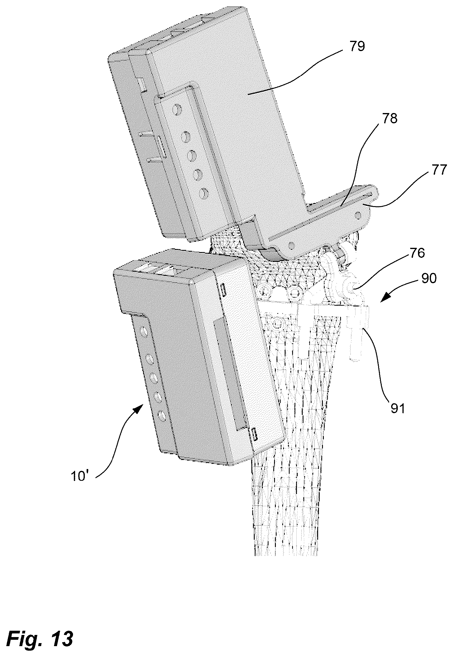 Patent US11812974 Figure 12 – Method and system for planning/guiding alterations to a bone