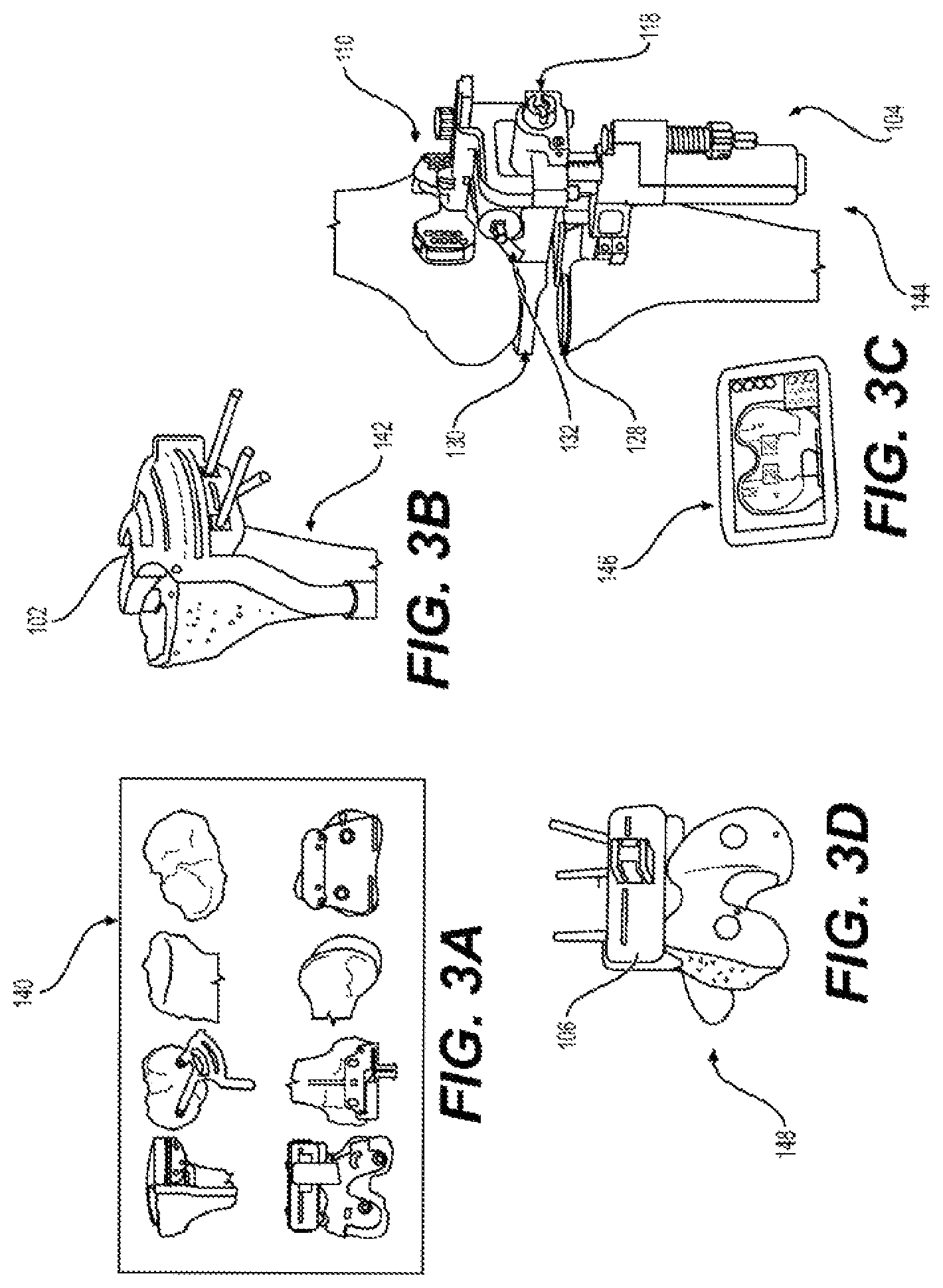 Patent US11812978 Figure 3 – Knee balancing system using patient specific instruments