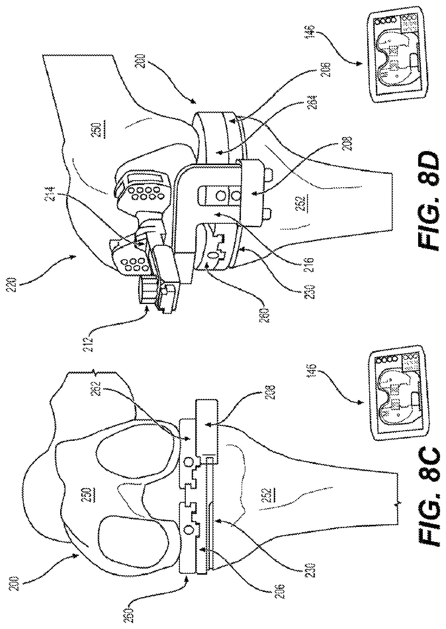 Patent US11812978 Figure 11 – Knee balancing system using patient specific instruments