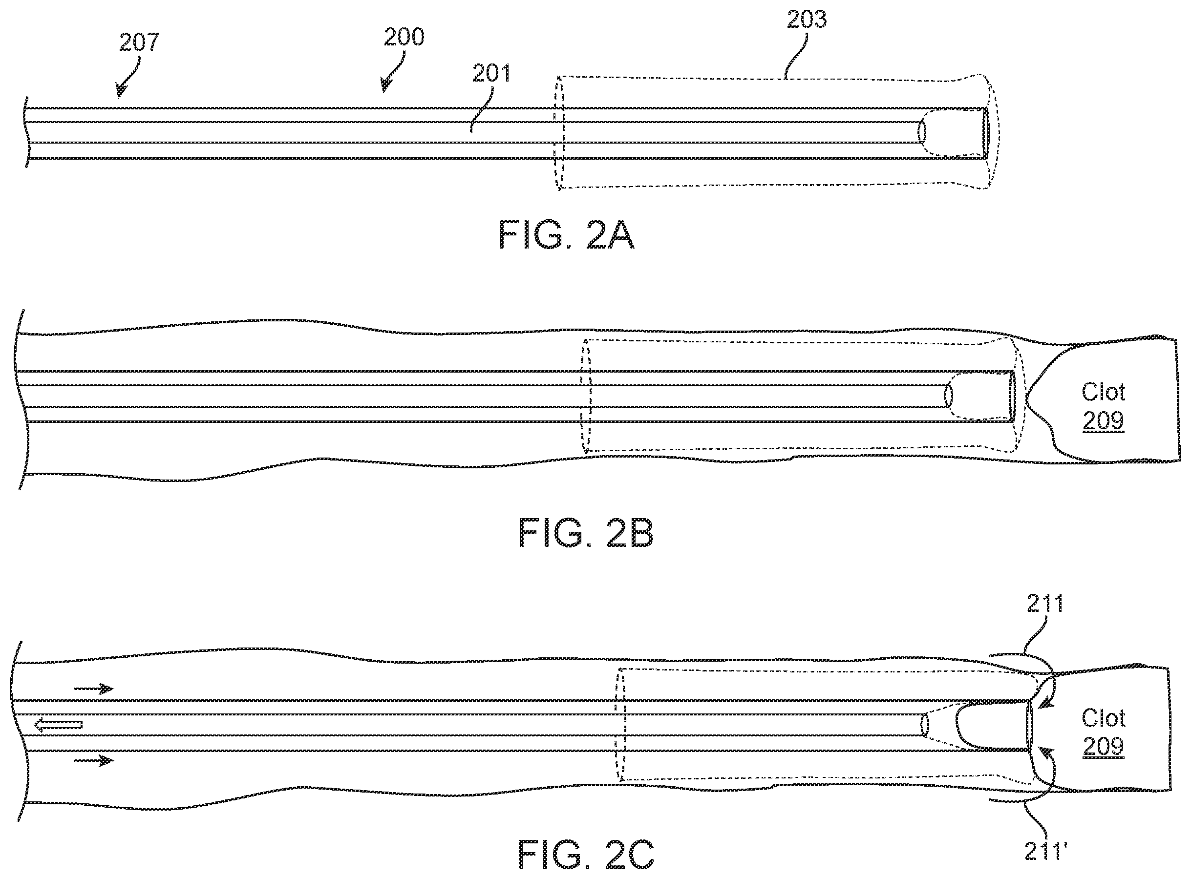 Patent US11812980 Figure 2 – Inverting thrombectomy apparatuses having enhanced tracking