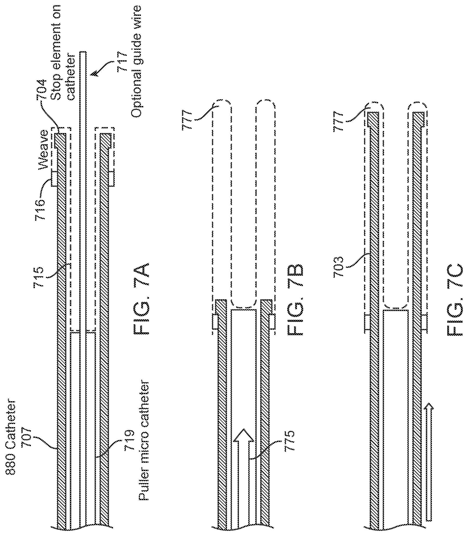 Patent US11812980 Figure 9 – Inverting thrombectomy apparatuses having enhanced tracking