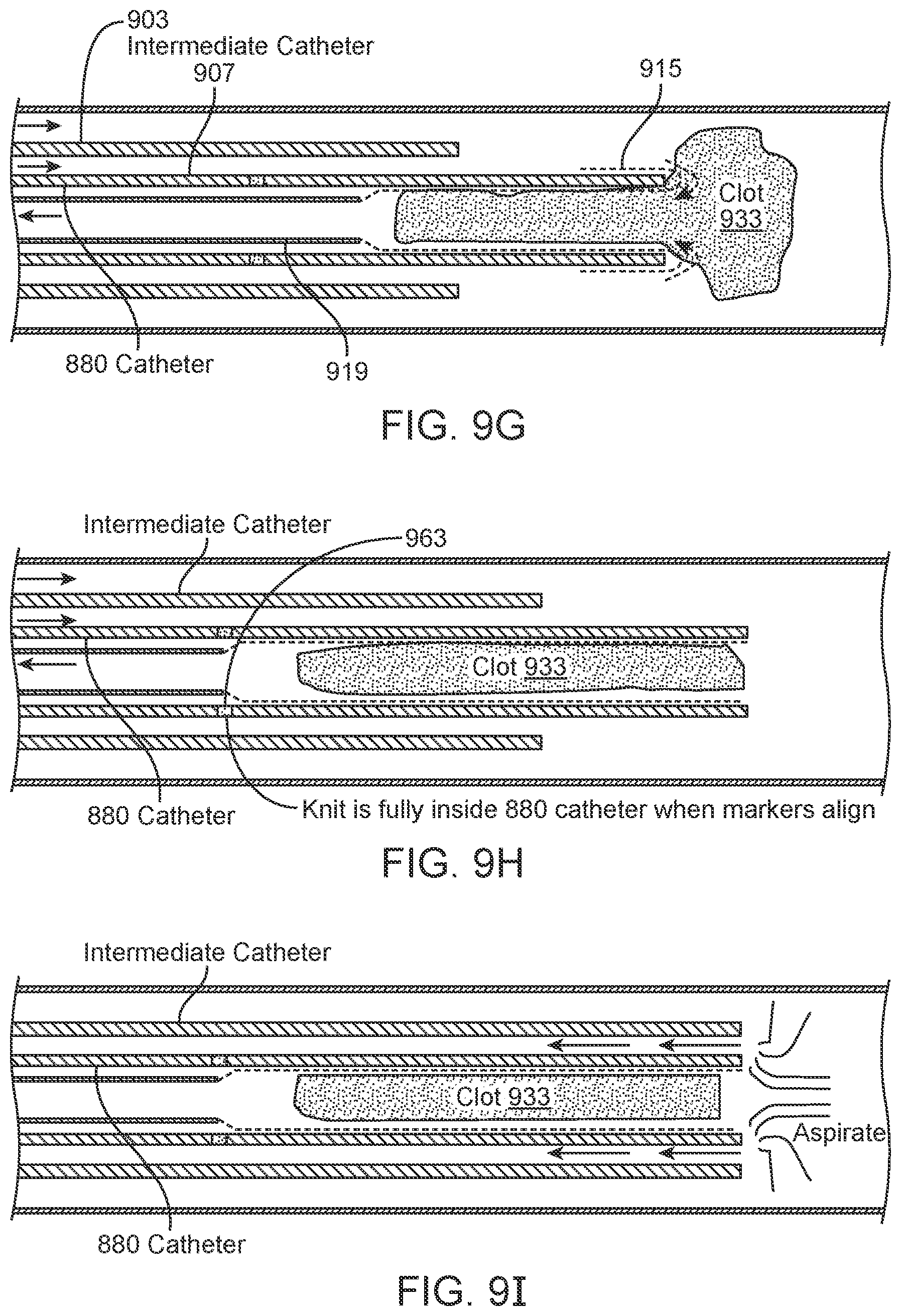 Patent US11812980 Figure 13 – Inverting thrombectomy apparatuses having enhanced tracking