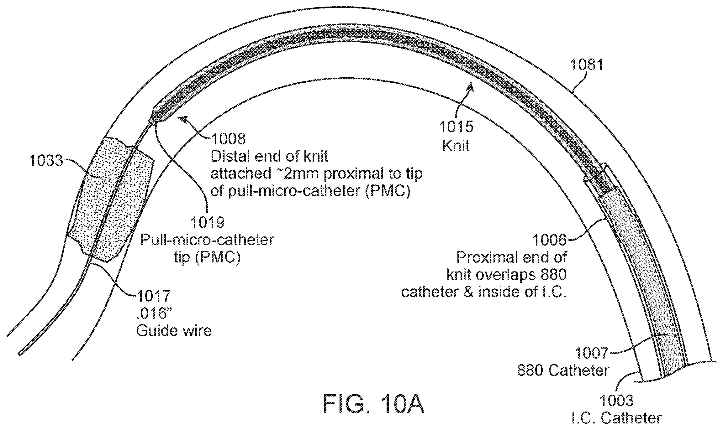 Patent US11812980 Figure 15 – Inverting thrombectomy apparatuses having enhanced tracking