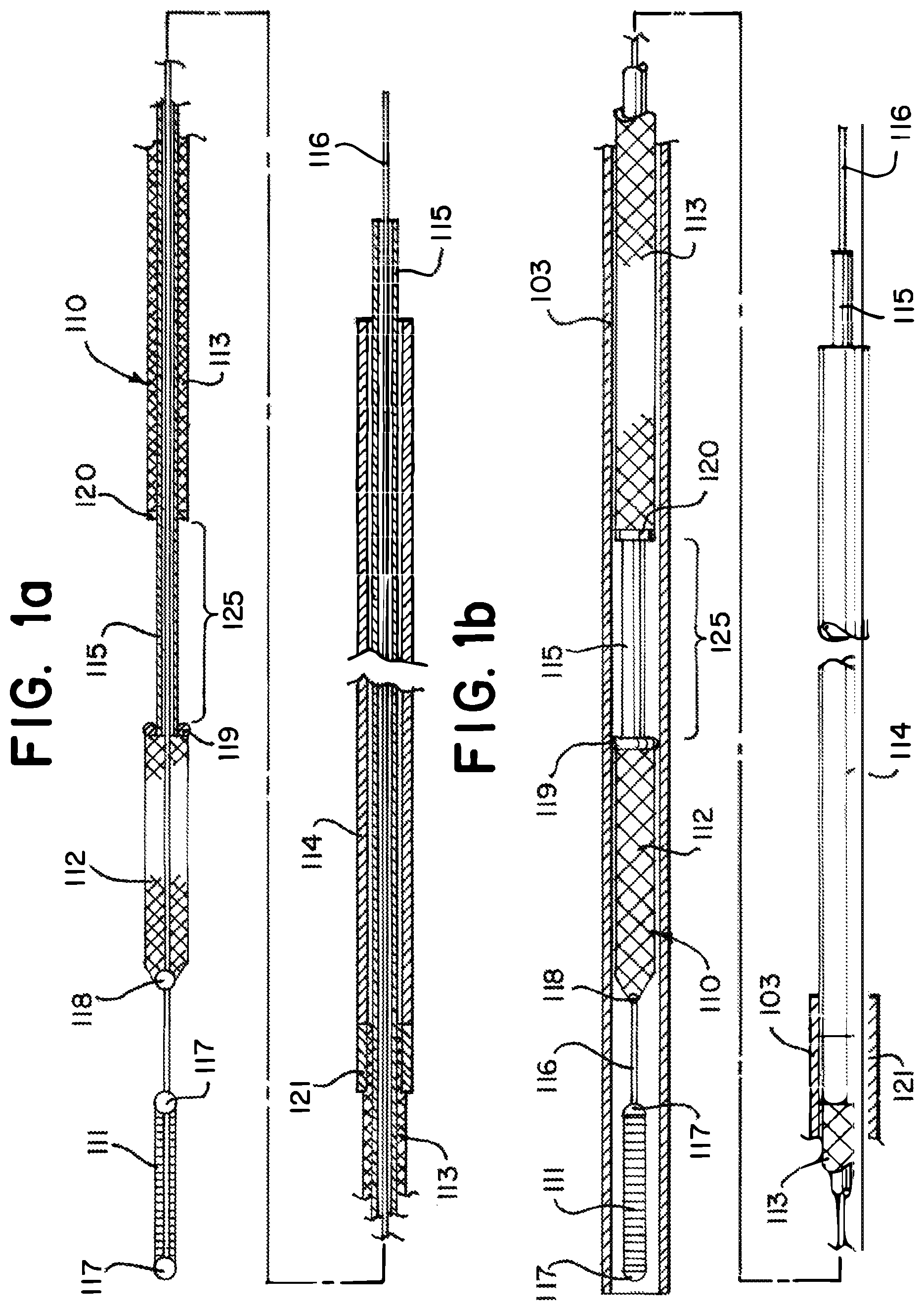 Patent US11812981 Figure 1 – Vasculature obstruction capture device