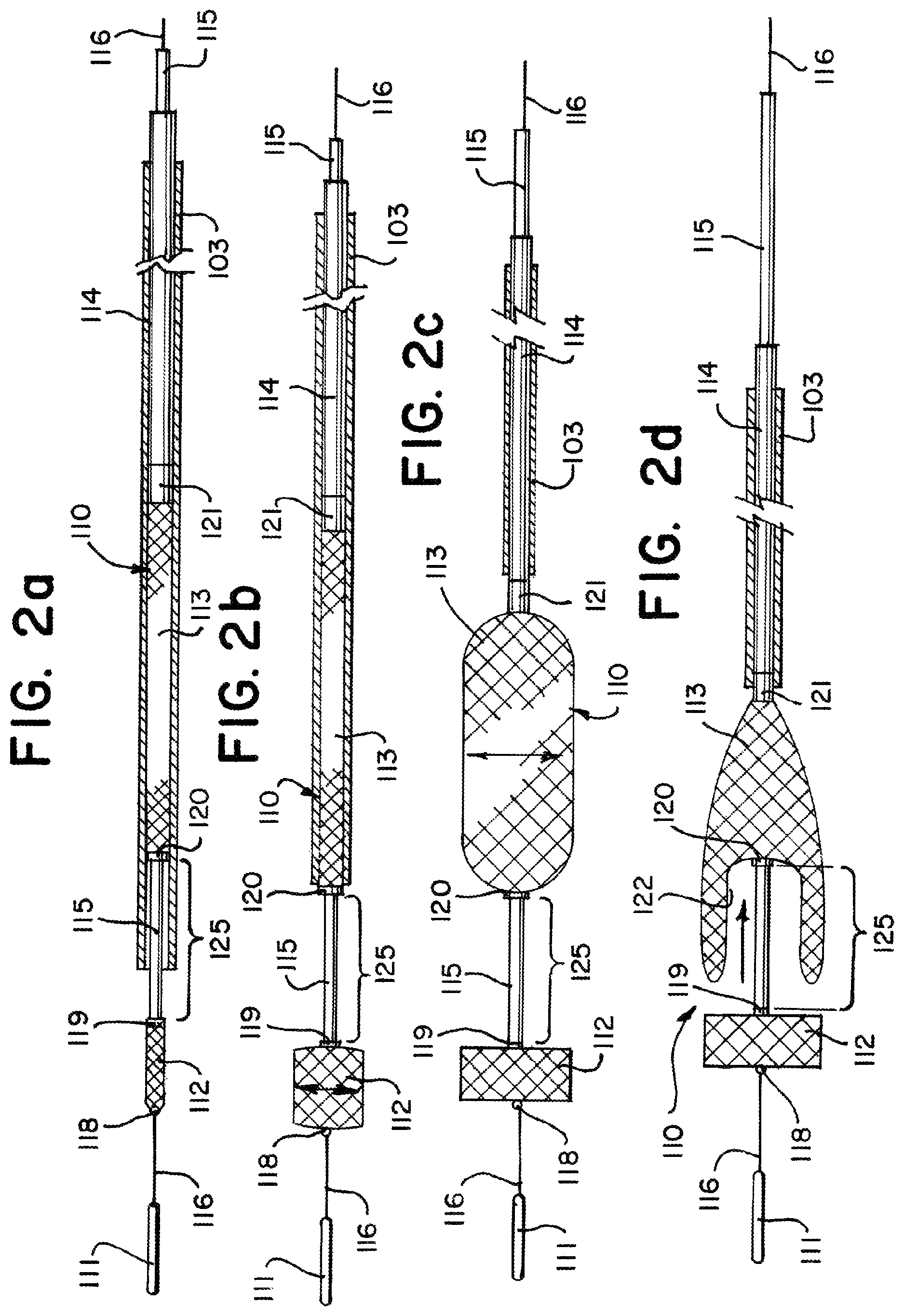 Patent US11812981 Figure 2 – Vasculature obstruction capture device