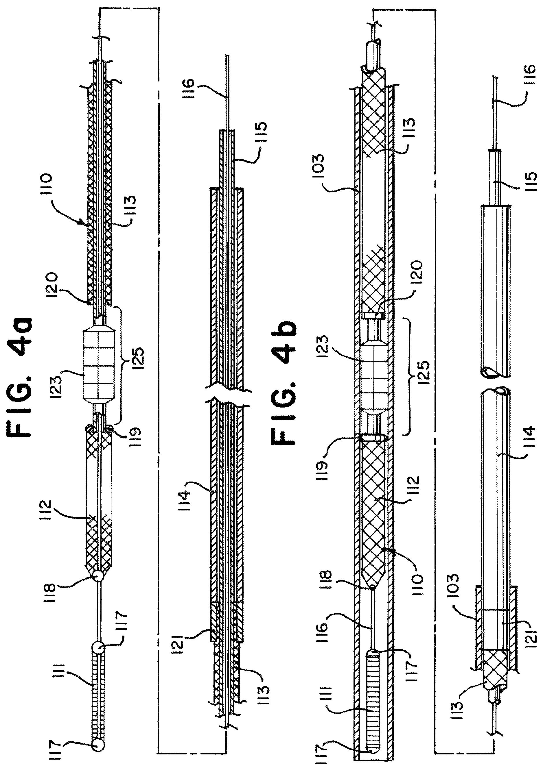 Patent US11812981 Figure 5 – Vasculature obstruction capture device