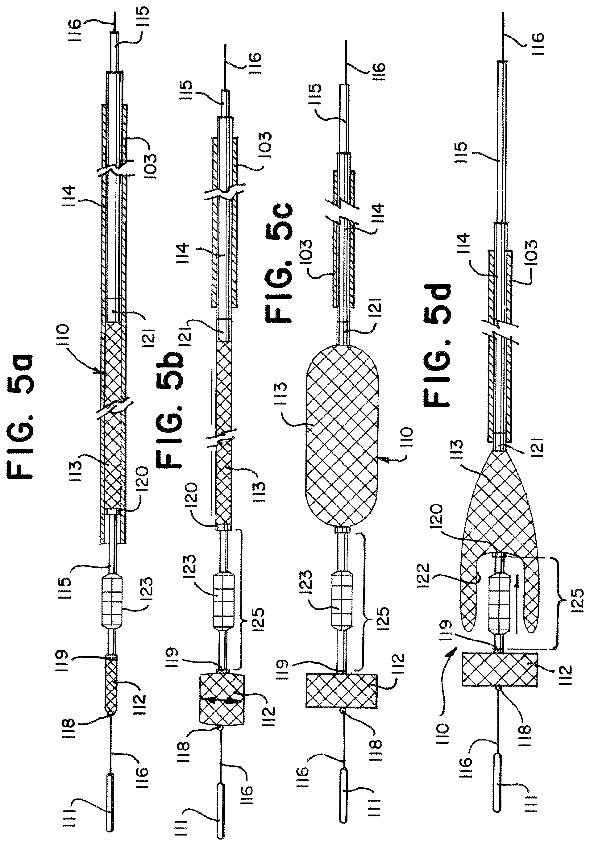 Patent US11812981 Figure 6 – Vasculature obstruction capture device