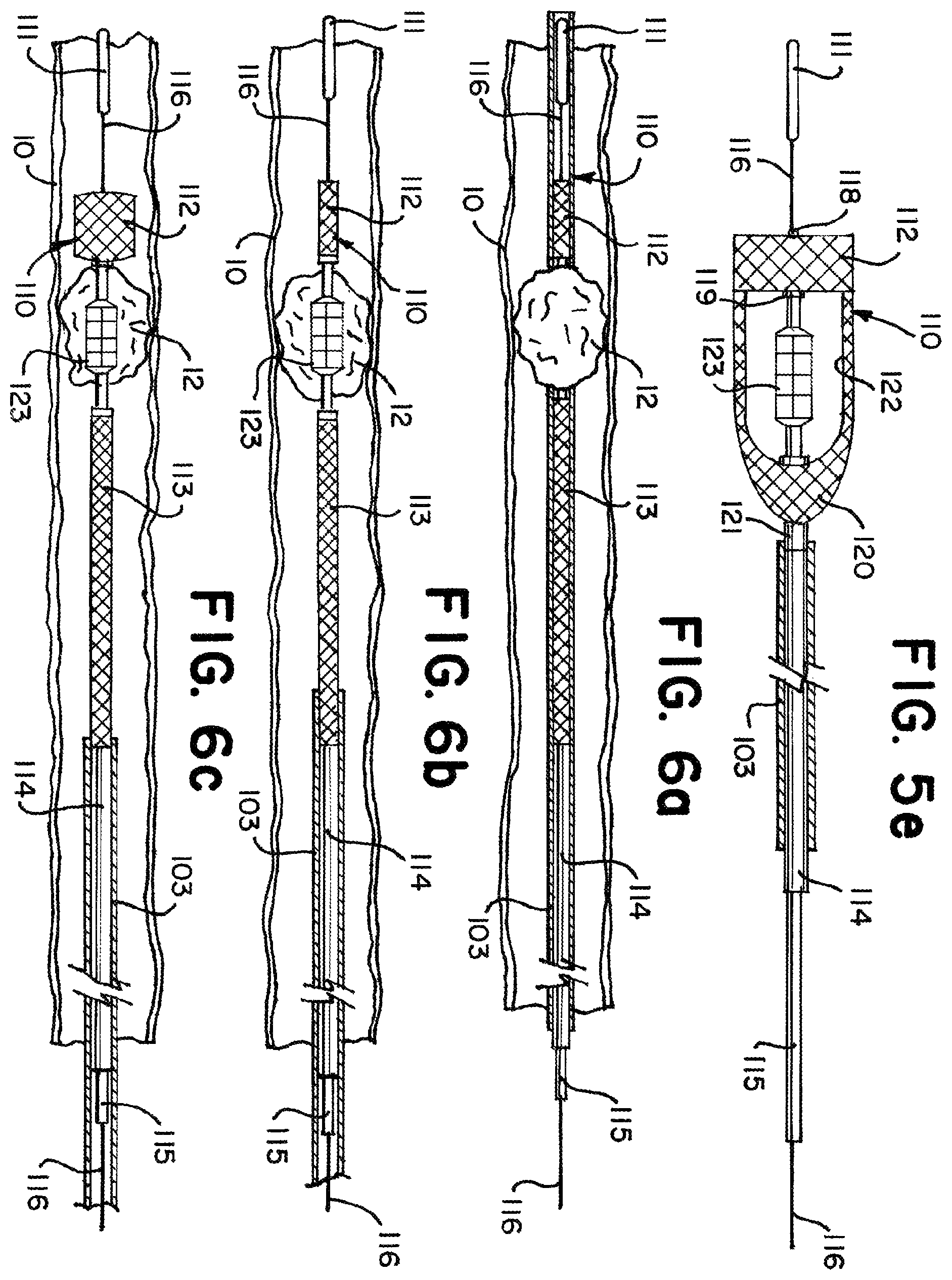 Patent US11812981 Figure 7 – Vasculature obstruction capture device