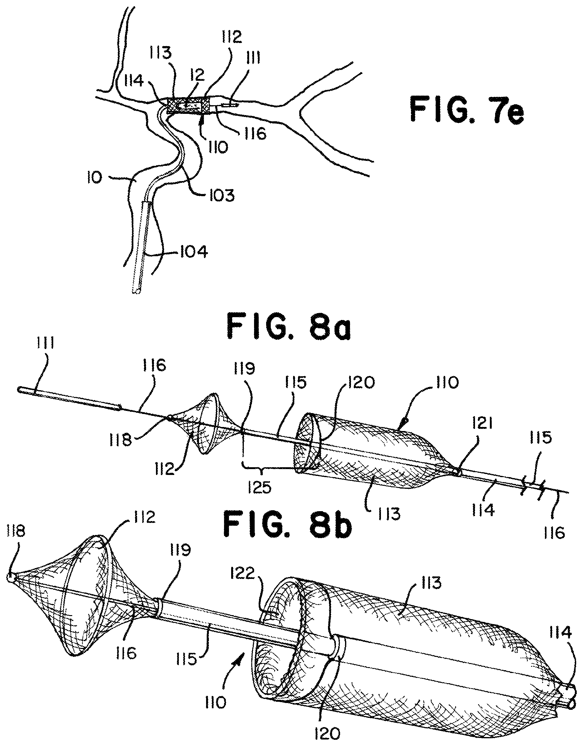 Patent US11812981 Figure 11 – Vasculature obstruction capture device