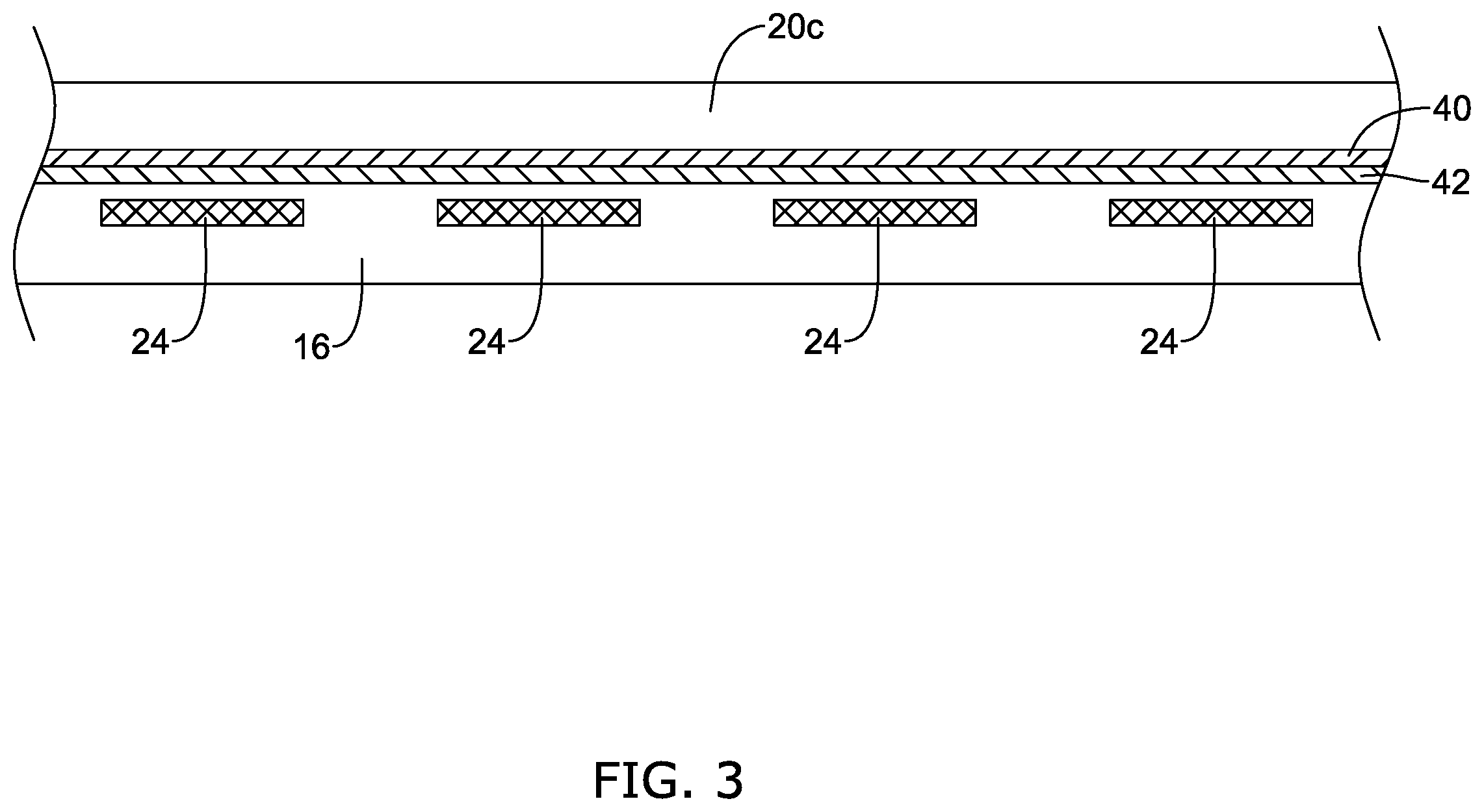 Patent US11812987 Figure 3 – Cutting balloon catheter