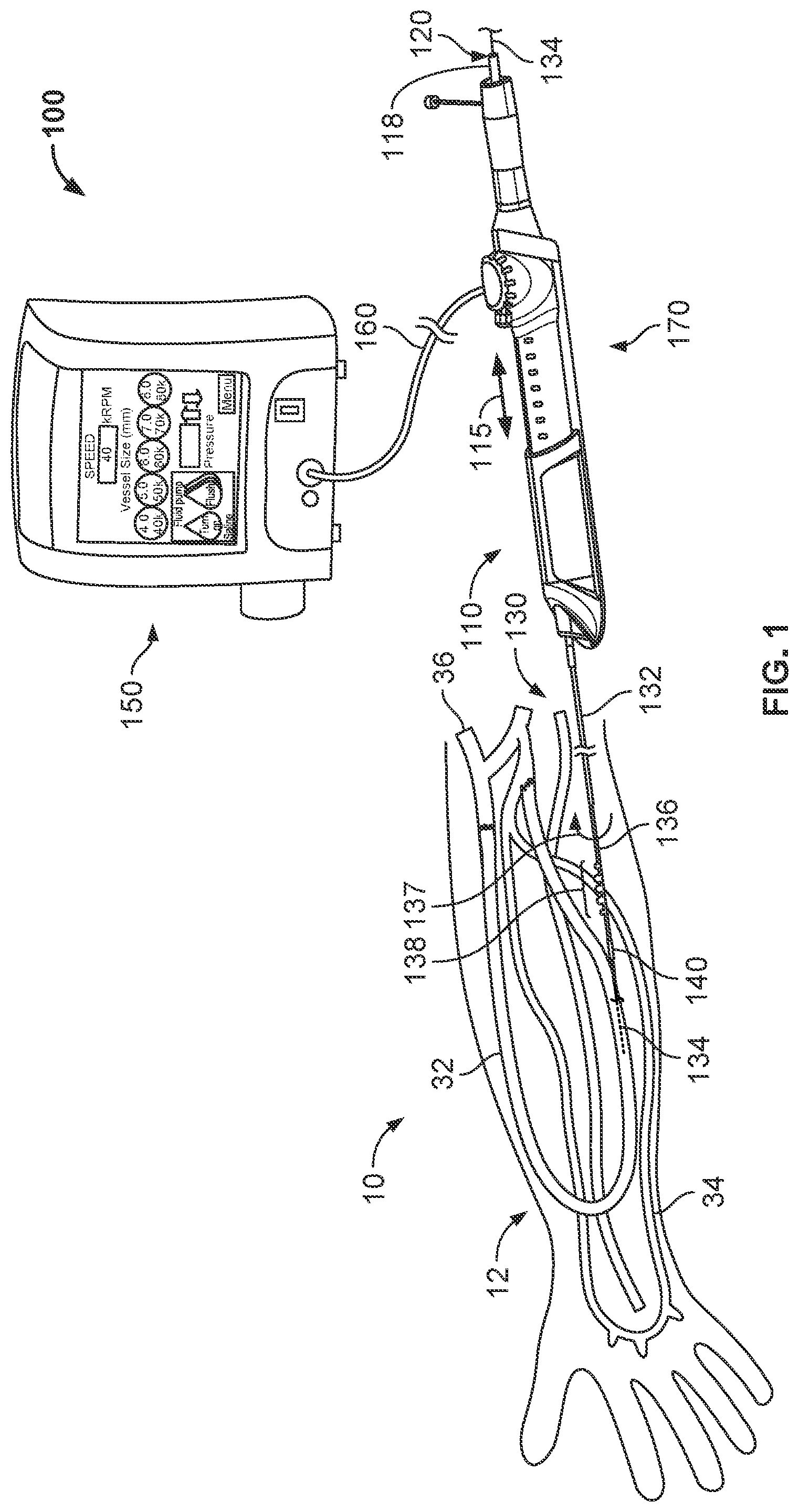 Patent US11812988 Figure 1 – Atherectomy devices and methods