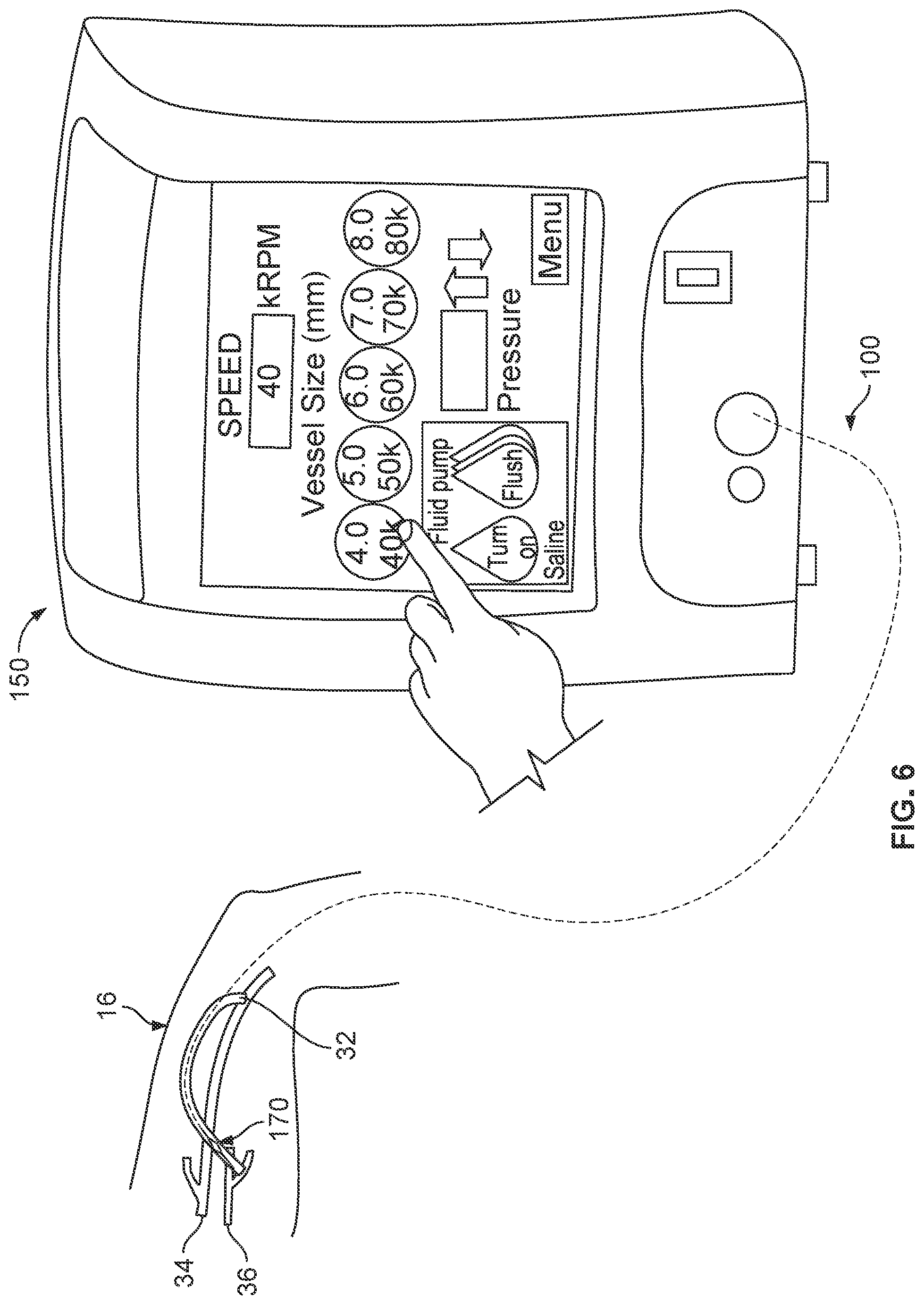 Patent US11812988 Figure 4 – Atherectomy devices and methods