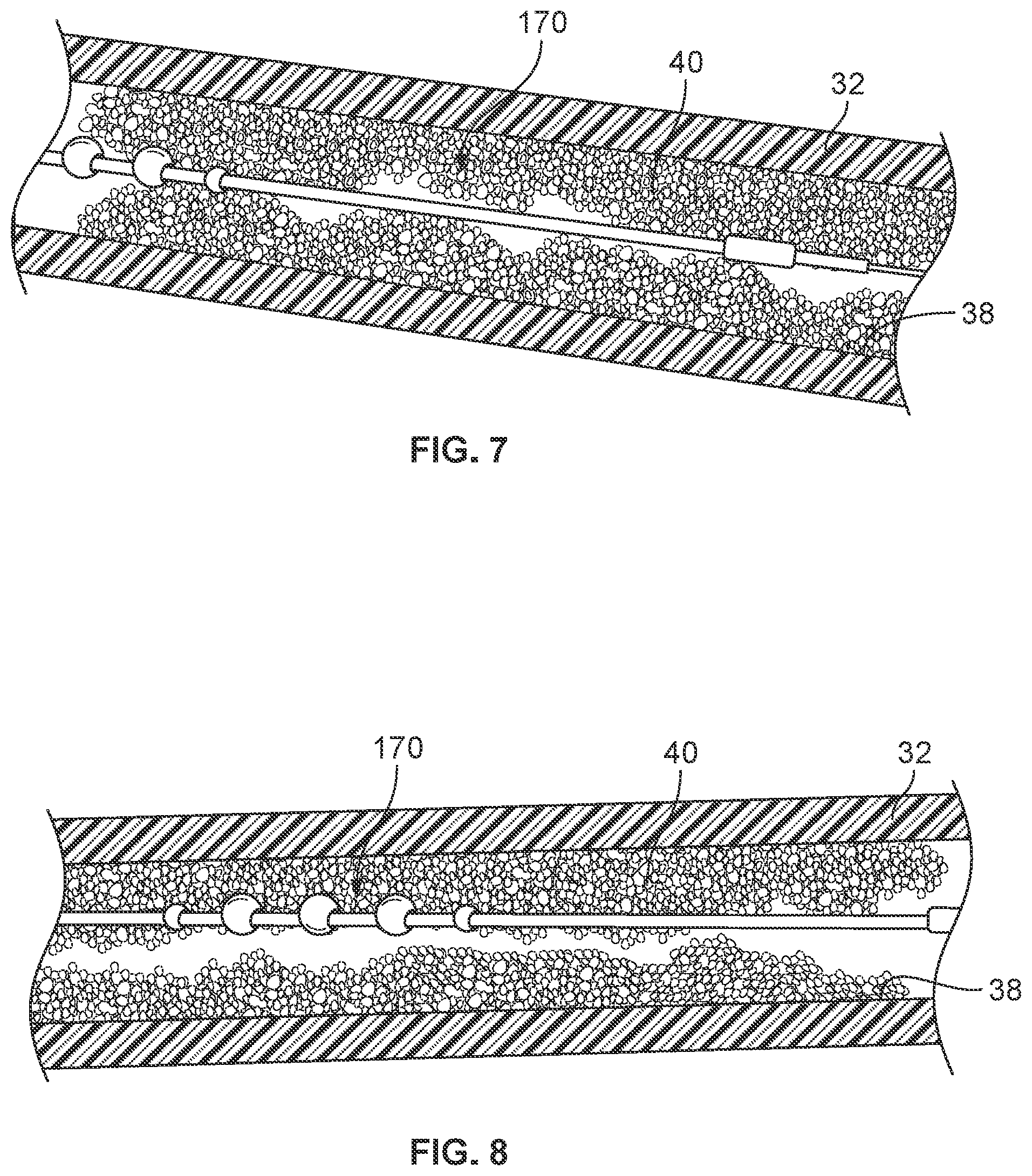 Patent US11812988 Figure 5 – Atherectomy devices and methods
