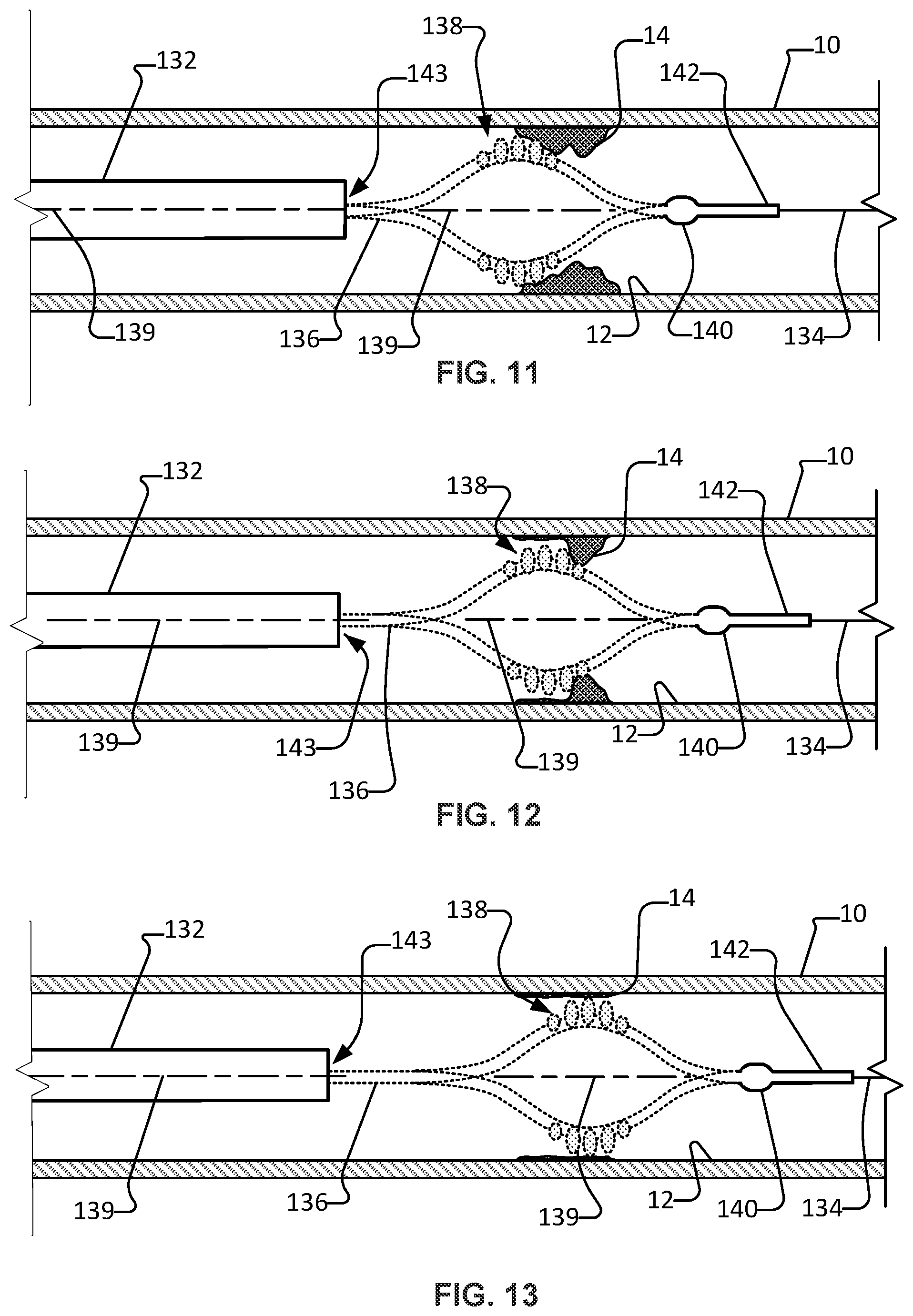 Patent US11812988 Figure 7 – Atherectomy devices and methods