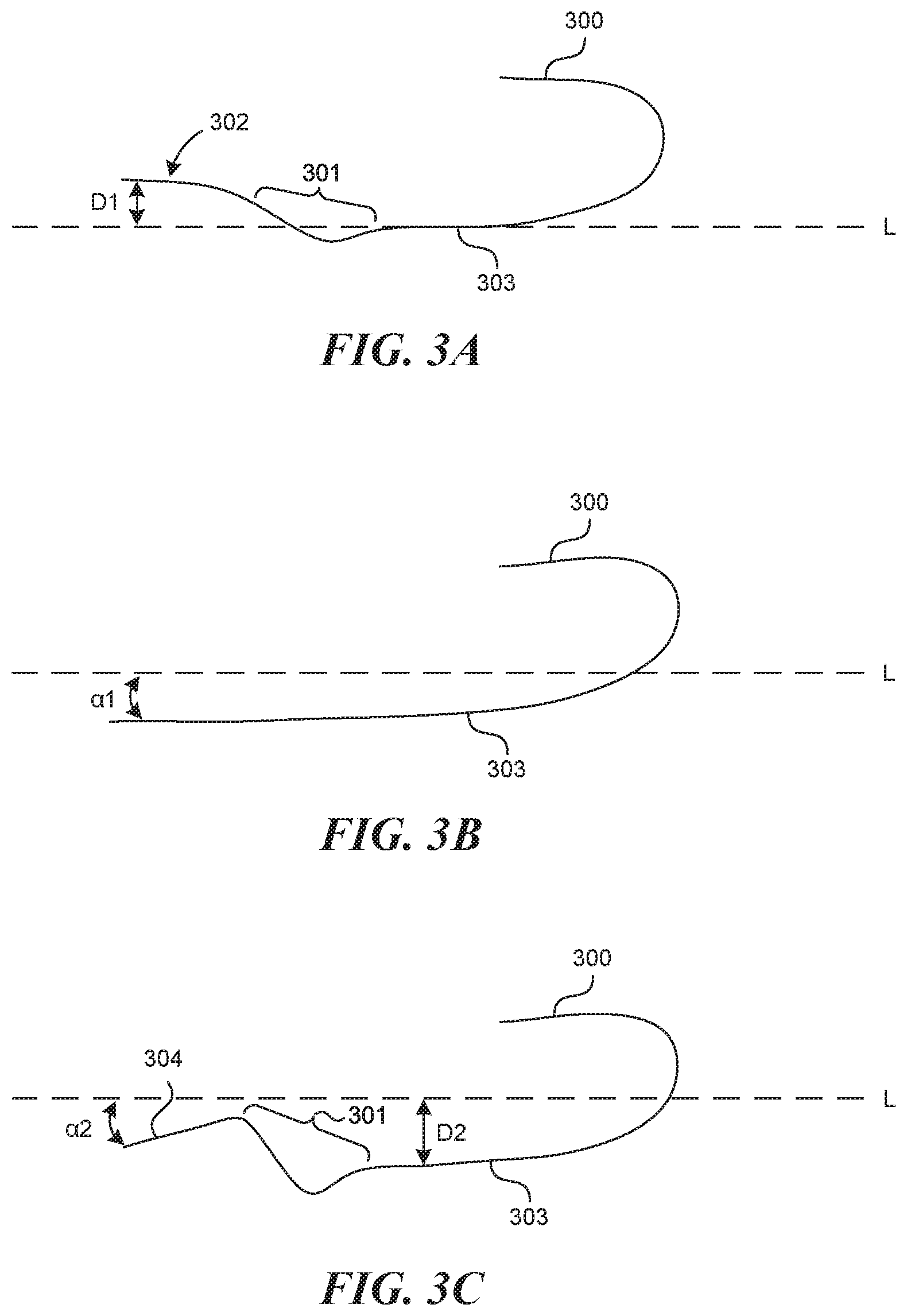 Patent US11812990 Figure 2 – Systems and methods for endoluminal valve creation