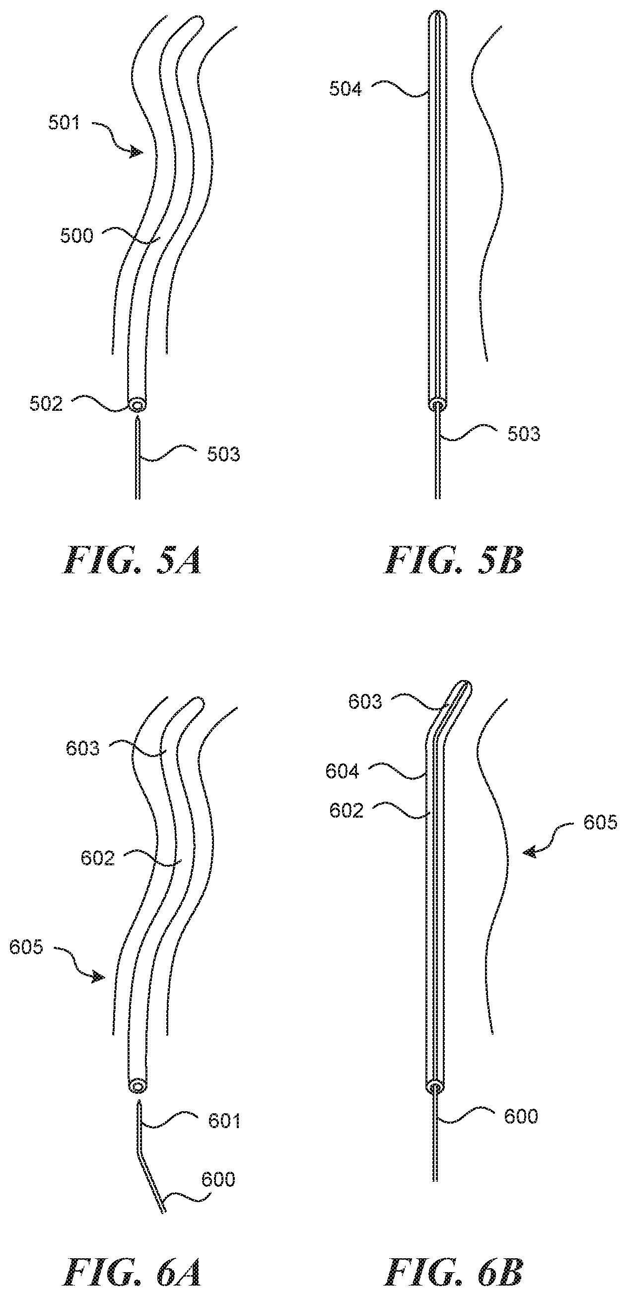 Patent US11812990 Figure 5 – Systems and methods for endoluminal valve creation