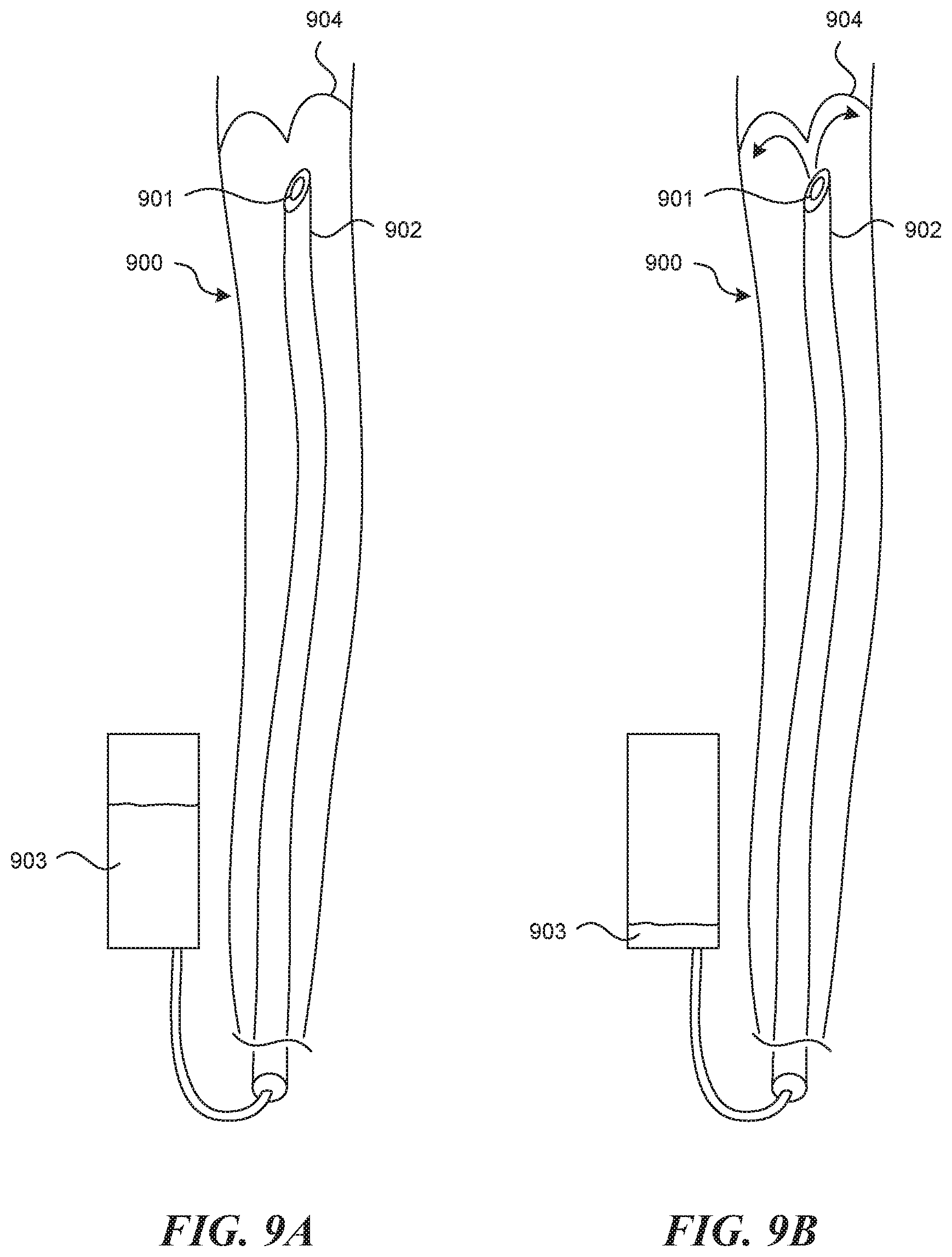 Patent US11812990 Figure 8 – Systems and methods for endoluminal valve creation