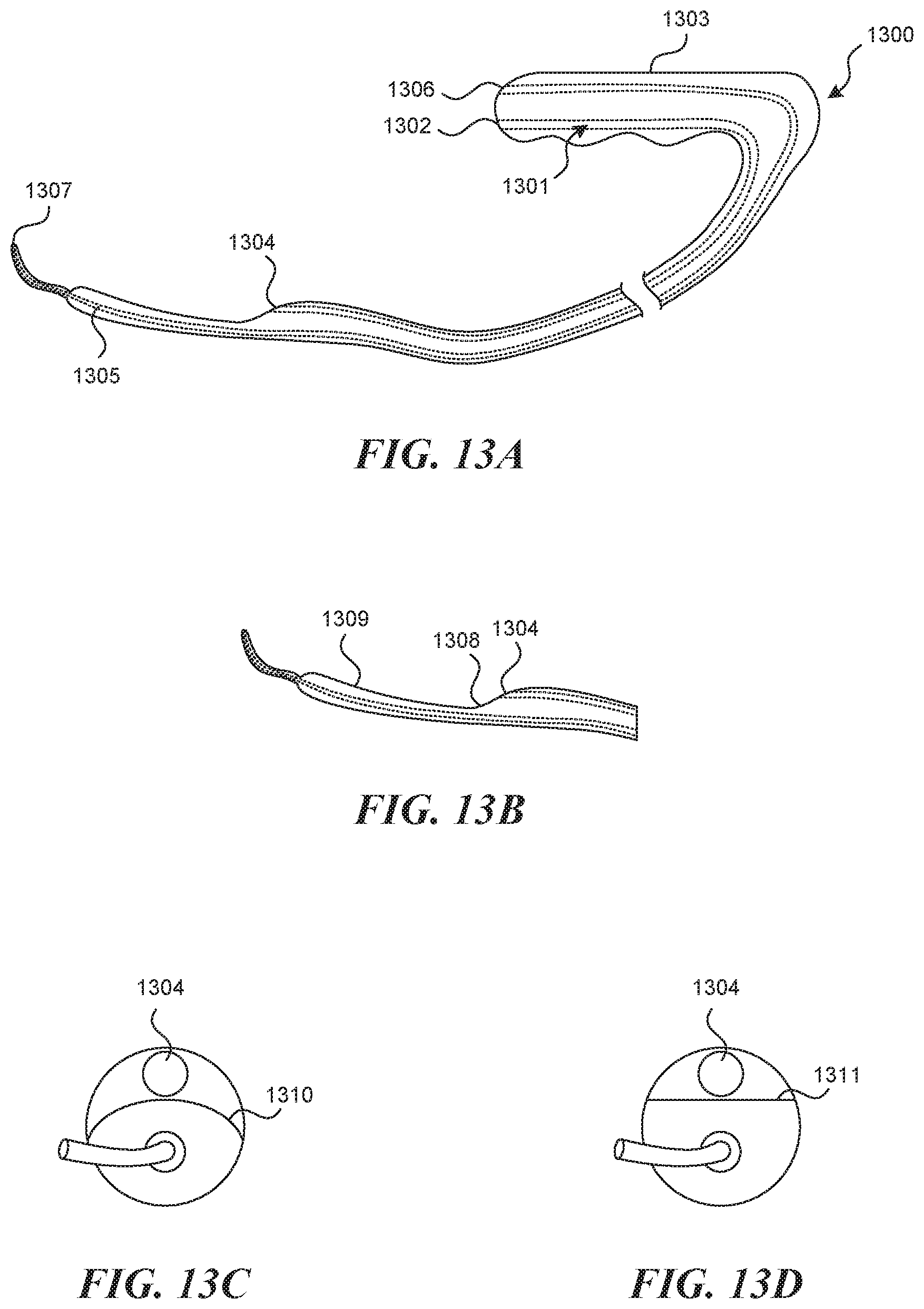 Patent US11812990 Figure 11 – Systems and methods for endoluminal valve creation