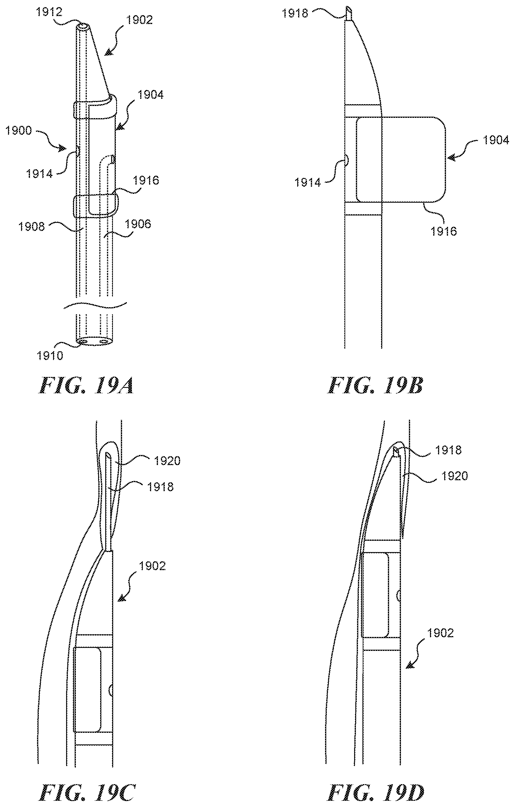 Patent US11812990 Figure 19 – Systems and methods for endoluminal valve creation