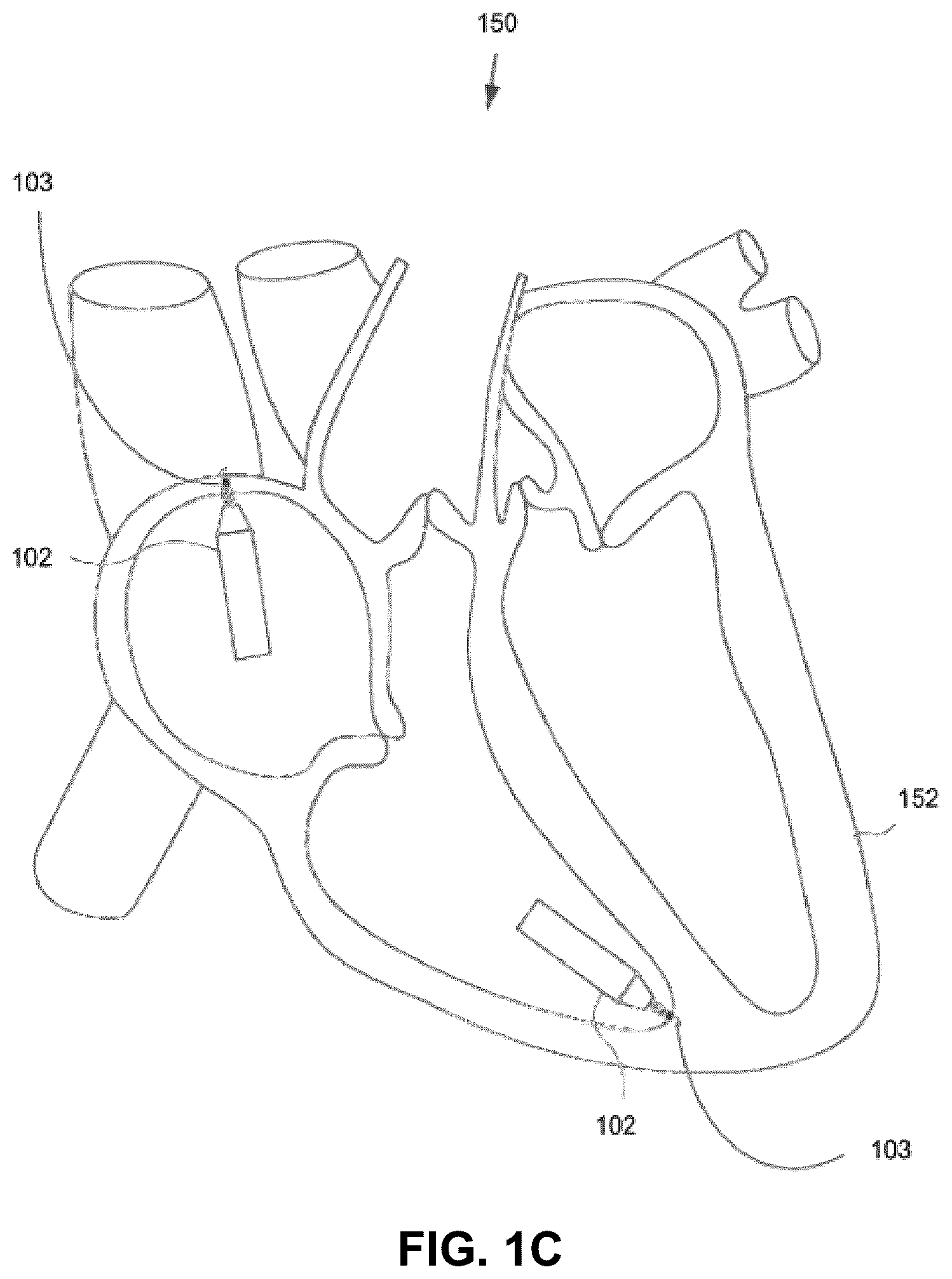 Patent US11812992 Figure 2 – Catheter-based system for delivery and retrieval of a leadless pacemaker