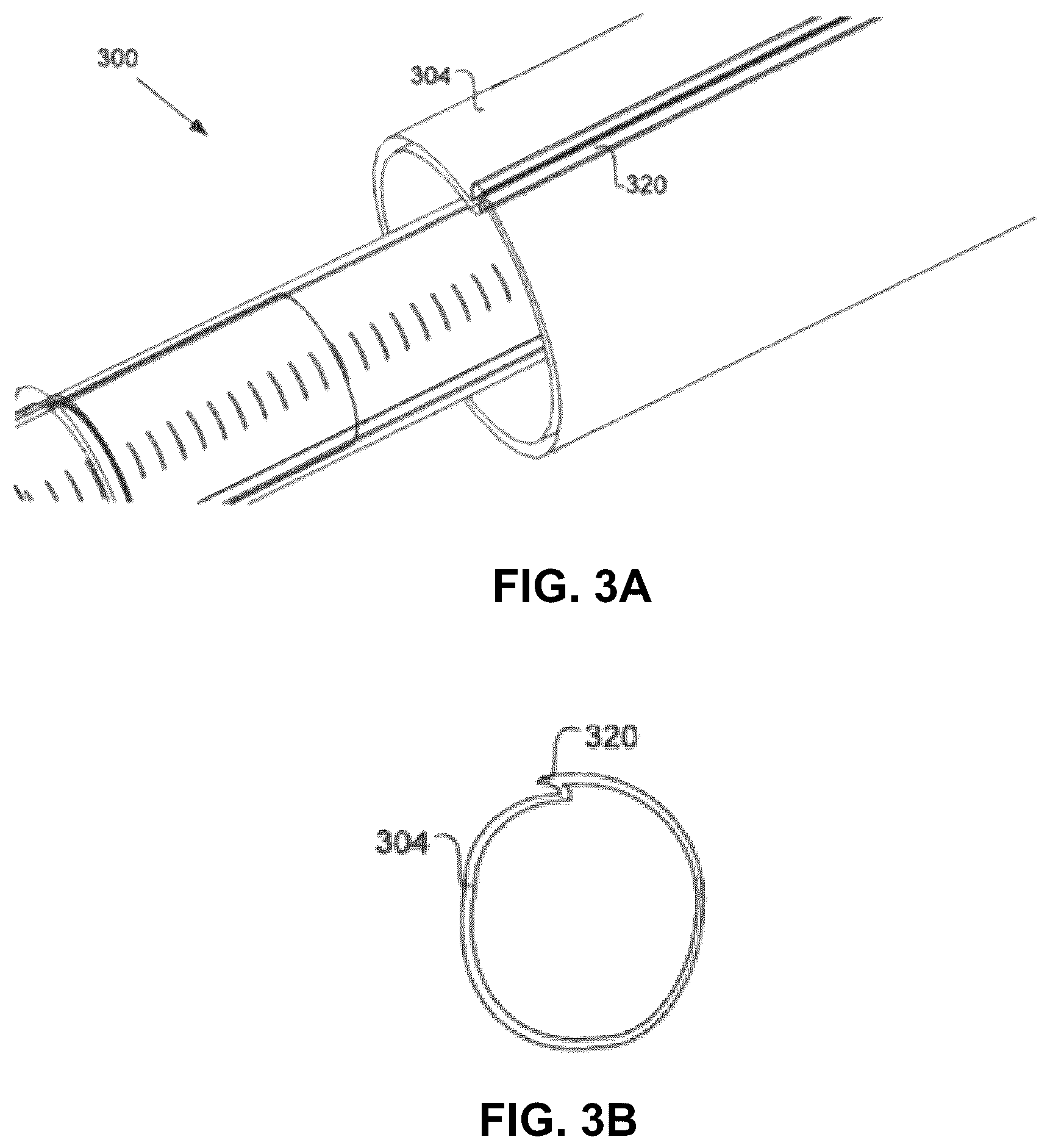 Patent US11812992 Figure 6 – Catheter-based system for delivery and retrieval of a leadless pacemaker