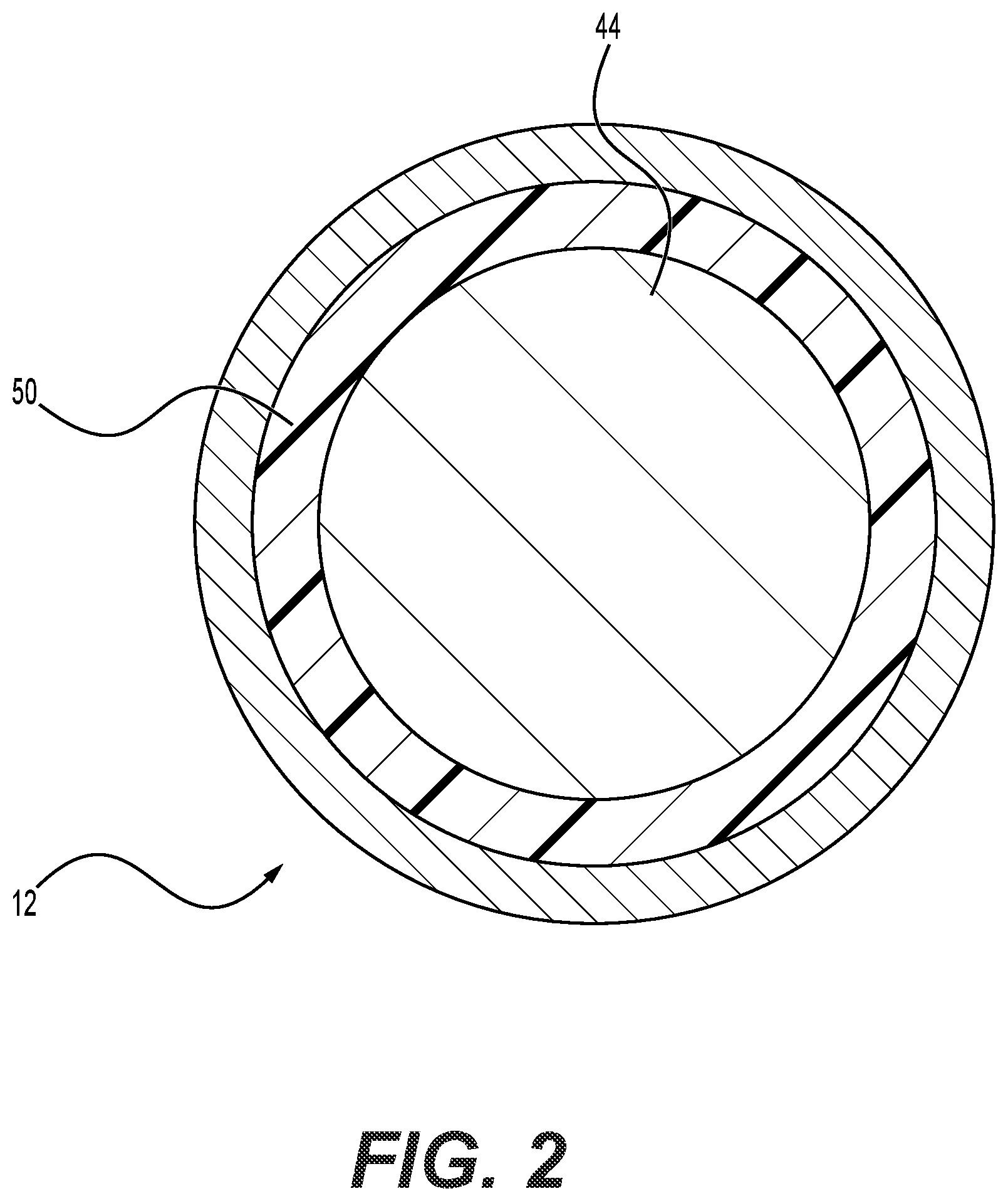 Patent US11812997 Figure 2 – System and method for treating early onset scoliosis
