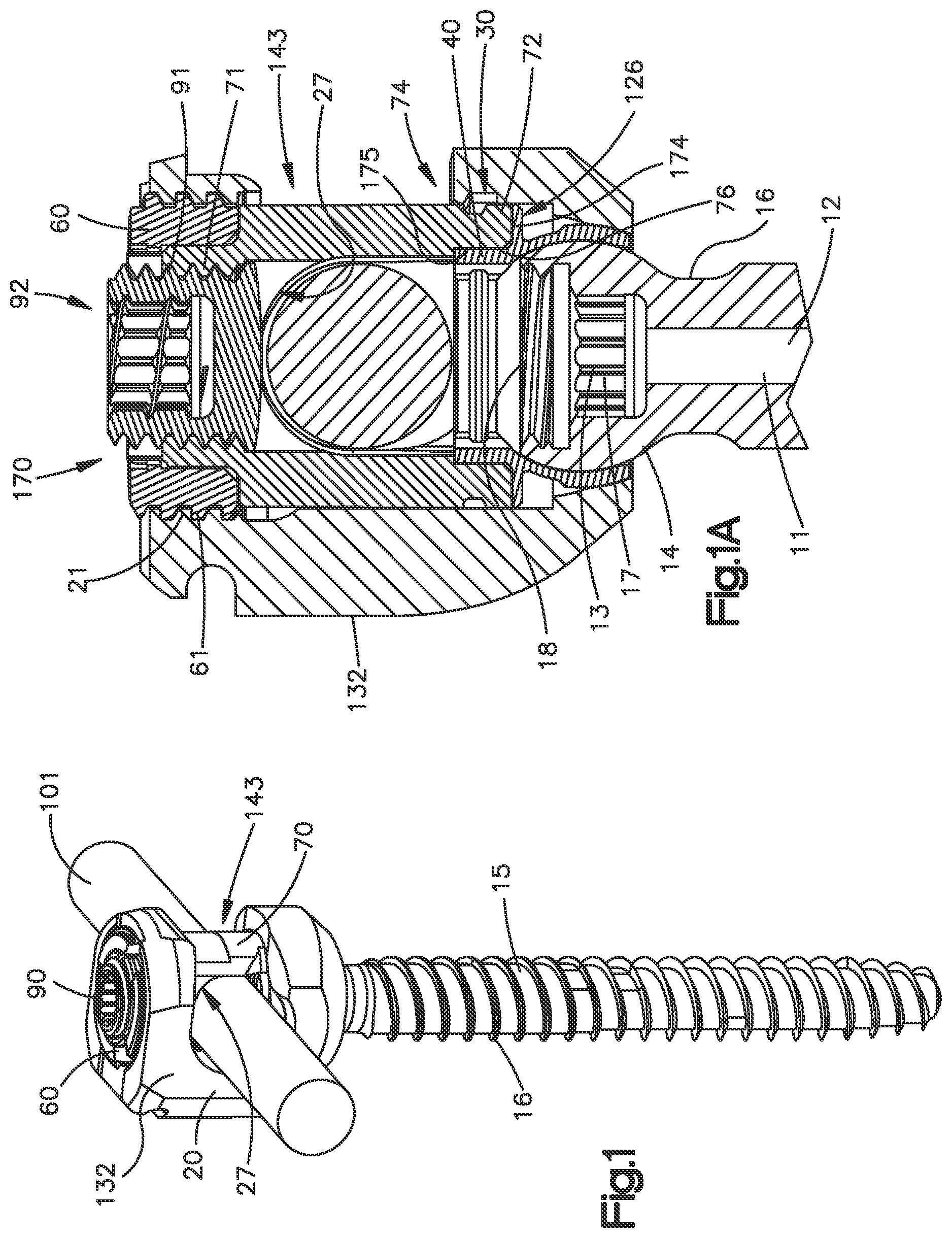 Patent US11812998 Figure 1 – Bone fixation assembly