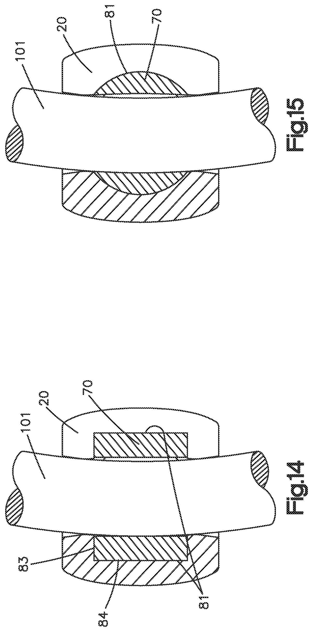 Patent US11812998 Figure 13 – Bone fixation assembly